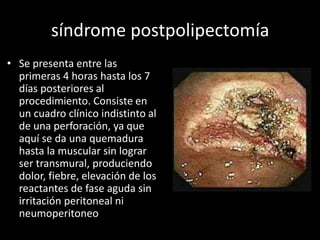 síndrome postpolipectomía
• Se presenta entre las
primeras 4 horas hasta los 7
días posteriores al
procedimiento. Consiste en
un cuadro clínico indistinto al
de una perforación, ya que
aquí se da una quemadura
hasta la muscular sin lograr
ser transmural, produciendo
dolor, fiebre, elevación de los
reactantes de fase aguda sin
irritación peritoneal ni
neumoperitoneo
 