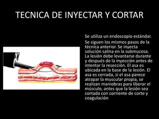 TECNICA DE INYECTAR Y CORTAR
Se utiliza un endoscopio estándar.
Se siguen los mismos pasos de la
técnica anterior. Se inyecta
solución salina en la submucosa.
La lesión debe levantarse durante
y después de la inyección antes de
intentar la resección. El asa es
ubicada en la base de la lesión. El
asa es cerrada, si el asa parece
atrapar la muscular propia, se
realizan maniobras para liberar el
músculo, antes que la lesión sea
cortada con corriente de corte y
coagulación
 