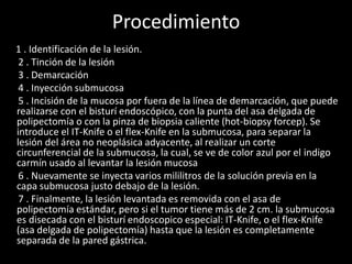 Procedimiento
1 . Identificación de la lesión.
2 . Tinción de la lesión
3 . Demarcación
4 . Inyección submucosa
5 . Incisión de la mucosa por fuera de la línea de demarcación, que puede
realizarse con el bisturí endoscópico, con la punta del asa delgada de
polipectomía o con la pinza de biopsia caliente (hot-biopsy forcep). Se
introduce el IT-Knife o el flex-Knife en la submucosa, para separar la
lesión del área no neoplásica adyacente, al realizar un corte
circunferencial de la submucosa, la cual, se ve de color azul por el indigo
carmín usado al levantar la lesión mucosa
6 . Nuevamente se inyecta varios mililitros de la solución previa en la
capa submucosa justo debajo de la lesión.
7 . Finalmente, la lesión levantada es removida con el asa de
polipectomía estándar, pero si el tumor tiene más de 2 cm. la submucosa
es disecada con el bisturí endoscopico especial: IT-Knife, o el flex-Knife
(asa delgada de polipectomía) hasta que la lesión es completamente
separada de la pared gástrica.
 