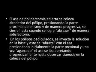 • El asa de polipectomia abierta se coloca
alrededor del pólipo, presionando la parte
proximal del mismo y de manera progresiva, se
cierra hasta cuando se logra “abrazar” de manera
satisfactoria.
• En los pólipos pediculados, se inyecta la solución
en la base y este se “abraza” con el asa
presionando inicialmente la parte proximal y una
vez “agarrado” el asa se iba apretando
progresivamente hasta observar cianosis en la
cabeza del pólipo.
 