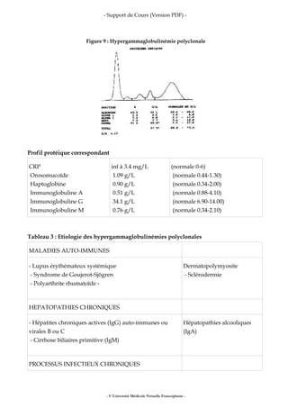 - Support de Cours (Version PDF) -
Figure 9 : Hypergammaglobulinémie polyclonale
Profil protéique correspondant
CRP
Orosomucoïde
Haptoglobine
Immunoglobuline A
Immunoglobuline G
Immunoglobuline M
inf à 3.4 mg/L
1.09 g/L
0.90 g/L
0.51 g/L
34.1 g/L
0.76 g/L
(normale 0-6)
(normale 0.44-1.30)
(normale 0.34-2.00)
(normale 0.88-4.10)
(normale 6.90-14.00)
(normale 0.34-2.10)
Tableau 3 : Etiologie des hypergammaglobulinémies polyclonales
MALADIES AUTO-IMMUNES
- Lupus érythémateux systémique
- Syndrome de Goujerot-Sjögren
- Polyarthrite rhumatoïde -
Dermatopolymyosite
- Sclérodermie
HEPATOPATHIES CHRONIQUES
- Hépatites chroniques actives (IgG) auto-immunes ou
virales B ou C
- Cirrhose biliaires primitive (IgM)
Hépatopathies alcooliques
(IgA)
PROCESSUS INFECTIEUX CHRONIQUES
- © Université Médicale Virtuelle Francophone -
 