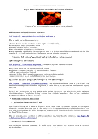 © UMVF - Université Médicale Virtuelle Francophone
Figure 15 bis : Traitement préventif du décollement de la rétine
c : aspect d’une photocoagulation récente autour d’une palissade.
e) Neuropahie optique ischémique antérieure
Voir chapitre 9 « Neuropathie optique ischémique antérieure ».
Elle se traduit par les éléments suivants :
• baisse d’acuité visuelle unilatérale brutale, le plus souvent massive,
• diminution du réflexe photomoteur direct,
• oedème papillaire total ou en secteur,
• déficit fasciculaire à l’examen du champ visuel.
• la cause la plus fréquente est l’artériosclérose, mais la NOIA doit faire systématiquement rechercher une
maladie de Horton nécessitant une corticothérapie par voie générale en urgence.
→ Anomalies de la vision d’apparition brutale avec fond d’oeil visible et normal
a) Névrite optique rétrobulbaire
Voir chapitre 6 « Œil et sclérose en plaques ».Elle se traduit par les éléments suivants :
• importante baisse d’acuité visuelle unilatérale brutale,
• douleurs oculaires augmentées lors des mouvements oculaires,
• réflexe photomoteur direct diminué,
• examen du fond d’oeil normal (plus rarement, oedème papillaire modéré),
• scotome central ou coeco-central à l’examen du champ visuel.
b) Atteintes des voies optiques chiasmatiques et rétro-chiasmatiques
Voir chapitre 21 « Altération de la fonction visuelle ».Une atteinte chiasmatique donne le plus souvent une
hémianopsie bitemporale d’installation progressive, la cause étant le plus souvent une compression d’origine
tumorale.
Devant une hémianopsie ou une quadranopsie latérale homonyme par atteinte des voies optiques
rétrochiasmatiques, l’installation brutale évoque une étiologie vasculaire, alors qu’une installation
progressive évoque une étiologie tumorale.
3. Anomalies transitoires de la vision
→ Cécité monoculaire transitoire (CMT)
Une disparition totale de la vision, d’apparition aiguë, d’une durée de quelques minutes, spontanément
résolutive constitue l’amaurose fugace ; elle correspond à un accident ischémique rétinien transitoire.C’est
une urgence diagnostique en raison du risque de survenue d’une occlusion artérielle rétinienne constituée
ou d’un AVC ischémique.
Elle doit faire rechercher avant tout un athérome carotidien ou une cardiopathie emboligène (voir chapitre 10
« Occlusions artérielles rétiniennes »).
→ Insuffisance vertébrobasilaire
Une amaurose transitoire bilatérale, de durée brève, peut traduire une ischémie dans le territoire
vertébrobasilaire.
10
 
