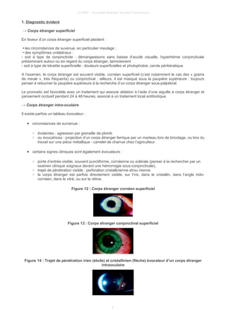 © UMVF - Université Médicale Virtuelle Francophone
1. Diagnostic évident
→ Corps étranger superficiel
En faveur d’un corps étranger superficiel plaident :
• les circonstances de suvenue, en particulier meulage ;
• des symptômes unilatéraux :
- soit à type de conjonctivite : démangeaisons sans baisse d’acuité visuelle, hyperhémie conjonctivale
prédominant autour ou en regard du corps étranger, larmoiement
- soit à type de kératite superficielle : douleurs superficielles et photophobie, cercle périkératique
A l’examen, le corps étranger est souvent visible, cornéen superficiel (c’est notamment le cas des « grains
de meule », très fréquents) ou conjonctival ; ailleurs, il est masqué sous la paupière supérieure : toujours
penser à retourner la paupière supérieure à la recherche d’un corps étranger sous-palpébral.
Le pronostic est favorable avec un traitement qui associe ablation à l’aide d’une aiguille à corps étranger et
pansement occlusif pendant 24 à 48 heures, associé à un traitement local antibiotique.
→ Corps étranger intra-oculaire
Il existe parfois un tableau évocateur :
● circonstances de survenue :
○ évidentes : agression par grenaille de plomb
○ ou évocatrices : projection d’un corps étranger ferrique par un marteau lors de bricolage, ou lors du
travail sur une pièce métallique - carrelet de charrue chez l’agriculteur.
● certains signes cliniques sont également évocateurs :
○ porte d’entrée visible, souvent punctiforme, cornéenne ou sclérale (penser à la rechercher par un
examen clinique soigneux devant une hémorragie sous-conjonctivale),
○ trajet de pénétration visible : perforation cristallinienne et/ou irienne.
○ le corps étranger est parfois directement visible, sur l’iris, dans le cristallin, dans l’angle irido-
cornéen, dans le vitré, ou sur la rétine.
Figure 12 : Corps étranger cornéen superficiel
Figure 13 : Corps étranger conjonctival superficiel
Figure 14 : Trajet de pénétration irien (étoile) et cristallinien (flèche) évocateur d’un corps étranger
intraoculaire
8
 