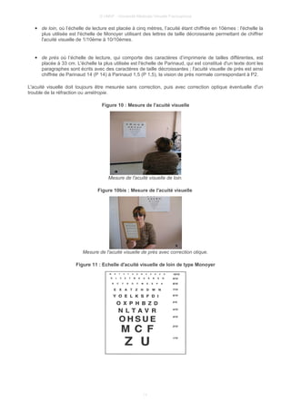 © UMVF - Université Médicale Virtuelle Francophone
● de loin, où l’échelle de lecture est placée à cinq mètres, l’acuité étant chiffrée en 10èmes : l'échelle la
plus utilisée est l'échelle de Monoyer utilisant des lettres de taille décroissante permettant de chiffrer
l'acuité visuelle de 1/10ème à 10/10èmes.
● de près où l’échelle de lecture, qui comporte des caractères d’imprimerie de tailles différentes, est
placée à 33 cm. L'échelle la plus utilisée est l'échelle de Parinaud, qui est constitué d'un texte dont les
paragraphes sont écrits avec des caractères de taille décroissantes ; l'acuité visuelle de près est ainsi
chiffrée de Parinaud 14 (P 14) à Parinaud 1,5 (P 1,5), la vision de près normale correspondant à P2.
L'acuité visuelle doit toujours être mesurée sans correction, puis avec correction optique éventuelle d'un
trouble de la réfraction ou amétropie.
Figure 10 : Mesure de l'acuité visuelle
Mesure de l'acuité visuelle de loin.
Figure 10bis : Mesure de l'acuité visuelle
Mesure de l'acuité visuelle de près avec correction otique.
Figure 11 : Echelle d'acuité visuelle de loin de type Monoyer
11
 