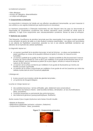 © UMVF - Université Médicale Virtuelle Francophone
Le traitement comprend :
• bilan allergique
• éviction de l’allergène, désensibilisation
• un collyre anti-allergique
3. Conjonctivites à chlamydia
La conjonctivite à inclusions de l’adulte est une affection sexuellement transmissible, qui peut s’associer à
une urétrite ou une vaginite (traitement par azythromycine en monodose).
Le trachome (conjonctivite à Chlamydia trachomatis) est très fréquent dans les pays du tiers-monde et
responsable de complications cornéennes très sévères (deuxième cause mondiale de cécité après la
cataracte). Il s’agit d’une conjonctivite avec néovascularisation cornéenne, fibrose du tarse et entropion.
4. Sydrome sec oculaire
Très fréquente, l’insuffisance de sécrétion lacrymale peut être responsable d’une rougeur oculaire associée
à une sensation de grains de sable ou à des douleurs oculaires superficielles ; ces signes sont secondaires
à une atteinte de l’épithélium conjonctival, associée ou non à une atteinte épithéliale cornéenne, par
altération de la trophicité des cellules épithéliales.
Le diagnostic repose sur :
● un examen quantitatif de la sécrétion lacrymale, le test de Schirmer ; on place une bandelette de
papier spécifique au niveau de la paupière inférieure et après 5 minutes, on mesure la zone
humidifiée ;
● un examen qualitatif de la qualité du film lacrymal : il étudie la stabilité du film lacrymal dont il mesure
le temps de rupture (Break-Up Time ou BUT) par instillation d’une goutte de fluorescéine dans le cul-
de-sac inférieur, puis on demande au patient de ne plus cligner, ensuite on mesure le temps de
rupture du film lacrymal.
● un examen de la surface cornéenne par instillation d’une goutte de fluorescéine qui montre une
kératite punctuée superficielle
● un examen de la surface conjonctivale par instillation d’une goutte de vert de Lissamine qui colore les
cellules mortes dans la zone d’ouverture palpébrale
L’étiologie est :
● le plus souvent une involution sénile des glandes lacrymales ;
● un syndrome de Gougerot-Sjögren.
La prise en charge repose sur :
● des substituts lacrymaux : larmes artificielles, gels, idéalement sans conservateurs
● une éviction les facteurs irritants : soleil (lunettes teintées), climatisation, air sec (humidificateurs,
tabac, poussières)
● l’occlusion temporaire ou permanente des points lacrymaux
● des traitements généraux (parasympatholytiques, fluidifiants)
Autres causes d’yeux rouges douloureux sans baisse d’acuité visuelle :
• Maladie de Basedow
• Malpositions palpébrales (entropion, ectropion, chalazions)
• Conjonctivite d’irritation : tabac, poussières.
Figure 11 : Conjonctivite printanière
8
 