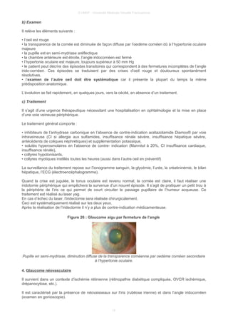 © UMVF - Université Médicale Virtuelle Francophone
b) Examen
Il relève les éléments suivants :
• l’oeil est rouge
• la transparence de la cornée est diminuée de façon diffuse par l’oedème cornéen dû à l’hypertonie oculaire
majeure
• la pupille est en semi-mydriase aréflectique
• la chambre antérieure est étroite, l’angle iridocornéen est fermé
• l’hypertonie oculaire est majeure, toujours supérieur à 50 mm Hg
• le patient peut décrire des épisodes transitoires qui correspondent à des fermetures incomplètes de l’angle
irido-cornéen. Ces épisodes se traduisent par des crises d’oeil rouge et douloureux spontanément
résolutives.
• l’examen de l’autre oeil doit être systématique car il présente la plupart du temps la même
prédisposition anatomique.
L’évolution se fait rapidement, en quelques jours, vers la cécité, en absence d’un traitement.
c) Traitement
Il s’agit d’une urgence thérapeutique nécessitant une hospitalisation en ophtalmologie et la mise en place
d’une voie veineuse périphérique.
Le traitement général comporte :
• inhibiteurs de l’anhydrase carbonique en l’absence de contre-indication acétazolamide Diamox® par voie
intraveineuse (CI si allergie aux sulfamides, insuffisance rénale sévère, insuffisance hépatique sévère,
antécédents de coliques néphrétiques) et supplémentation potassique,
• solutés hyperosmolaires en l’absence de contre- indication (Mannitol à 20%, CI insuffisance cardiaque,
insuffisance rénale),
• collyres hypotonisants,
• collyres myotiques instillés toutes les heures (aussi dans l’autre oeil en préventif)
La surveillance du traitement repose sur l’ionogramme sanguin, la glycémie, l’urée, la créatininémie, le bilan
hépatique, l’ECG (électroencéphalogramme).
Quand la crise est jugulée, le tonus oculaire est revenu normal, la cornée est claire, il faut réaliser une
iridotomie périphérique qui empêchera la survenue d’un nouvel épisode. Il s’agit de pratiquer un petit trou à
la périphérie de l’iris ce qui permet de court circuiter le passage pupillaire de l’humeur acqueuse. Ce
traitement est réalisé au laser yag.
En cas d’échec du laser, l’iridectomie sera réalisée chirurgicalement.
Ceci est systématiquement réalisé sur les deux yeux.
Après la réalisation de l’iridectomie il n’y a plus de contre-indication médicamenteuse.
Figure 26 : Glaucome aigu par fermeture de l’angle
Pupille en semi-mydriase, diminution diffuse de la transparence cornéenne par oedème cornéen secondaire
à l’hypertonie oculaire.
4. Glaucome néovasculaire
Il survient dans un contexte d’ischémie rétinienne (rétinopathie diabétique compliquée, OVCR ischémique,
drépanocytose, etc.).
Il est caractérisé par la présence de néovaisseaux sur l’iris (rubéose irienne) et dans l’angle iridocornéen
(examen en gonioscopie).
15
 