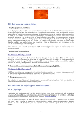 © UMVF - Université Médicale Virtuelle Francophone
Figure 8 : OEdème maculaire modéré, entouré d'exsudats
3.3. Examens complémentaires
1. La photographie du fond d’oeil
La photographie du fond est la base des classifications modernes de la RD; C’est l’examen de référence
pour diagnostiquer la RD, elle permet d’avoir un document de référence. Des photographies du pôle
postérieur et de toute la périphérie sont réalisées. La photographie permet de visualiser les différents signes
de la RD, et de quantifier l’ischémie rétinienne périphérique. En effet, la gravité de celle-ci est estimée par le
nombre et la sévérité d’un certain nombre de signes cliniques (hémorragies intra-rétiniennes «en taches»,
anomalies veineuses, AMIRs). La photographie du fond d’oeil est également uitilisée pour le dépistage de la
RD qui d’adresse aux patients sans RD connue. Les photographies peuvent être prises en général sans
dilatation pupillaire par des techniciens non médecins, à l’aide de rétinographes non mydriatiques et être
lues de façon différée par l’ophtalmologiste.
Cette méthode a une sensiblité pour dépister la RD au moins égale voire supérieure à celle de l’examen
ophtalmoscopique.
2. Angiographie fluorescéinique
Voir chapitre 1 : "Sémiologie oculaire".
Elle n’est qu’un complément de l’examen et de la photographie du fond d’oeil. Elle ne doit pas être
demandée de façon systématique. Elle aide au traitement par photocoagulation au laser des oedèmes
maculaires et évalue le degré d’ischémie maculaire. Ele permet de décleer une hyperperméabilité capillaire
(diffusion de colorant) et d'apprécier la perfusion capillaire rétinienne.
3. Tomographie en cohérence optique (Optical Coherence Tomography (OCT))
Voir chapitre 1 : "Sémiologie oculaire".
L'OCT est essentielle pour le diagnostic et le suivi de l’oedème maculaire en montrant des coupes en profil
de la macula et en permettant de mesurer l'épaisseur de l'oedème maculaire.
4. Échographie en mode B
Elle est utile, en cas d’hémorragie du vitré massive empêchant l’examen du fond d’oeil, pour dépister un
éventuel décollement de rétine par traction sous-jacent.
3.4. Modalités de dépistage et de surveillance
3.4.1. Dépistage
Il s’adresse aux diabétiques sans RD. Un large consensus existe pour recommander une surveillance
annuelle du fond d’oeil de tout patient diabétique, de préférence par photographie du fond d’oeil, à défaut par
biomicroscopie à la lampe à fente, après dilatation pupillaire (www.has-sante.fr).
Chez un diabétique de type 1 : le début du diabète est connu avec précision. La RD ne survient en général
pas avant 7 ans d’évolution du diabète. Un examen du fond d’oeil par photographies du fond d’oeil sera
réalisé à la découverte du diabète, puis tous les ans, ou éventuellement à partir de la 5ième année de
diabète.
7
 
