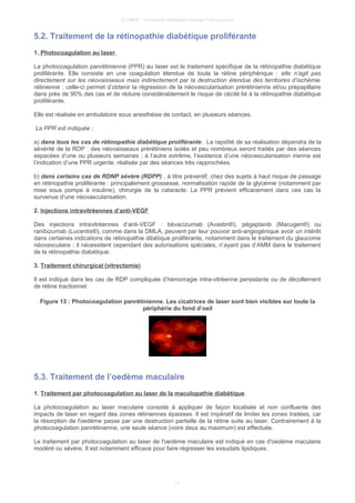 © UMVF - Université Médicale Virtuelle Francophone
5.2. Traitement de la rétinopathie diabétique proliférante
1. Photocoagulation au laser
La photocoagulation panrétinienne (PPR) au laser est le traitement spécifique de la rétinopathie diabétique
proliférante. Elle consiste en une coagulation étendue de toute la rétine périphérique : elle n’agit pas
directement sur les néovaisseaux mais indirectement par la destruction étendue des territoires d’ischémie
rétinienne : celle-ci permet d’obtenir la régression de la néovascularisation prérétinienne et/ou prépapillaire
dans près de 90% des cas et de réduire considérablement le risque de cécité lié à la rétinopathie diabétique
proliférante.
Elle est réalisée en ambulatoire sous anesthésie de contact, en plusieurs séances.
La PPR est indiquée :
a) dans tous les cas de rétinopathie diabétique proliférante . La rapidité de sa réalisation dépendra de la
sévérité de la RDP : des néovaisseaux prérétiniens isolés et peu nombreux seront traités par des séances
espacées d’une ou plusieurs semaines ; à l’autre extrême, l’existence d’une néovascularisation irienne est
l’indication d’une PPR urgente, réalisée par des séances très rapprochées.
b) dans certains cas de RDNP sévère (RDPP) , à titre préventif, chez des sujets à haut risque de passage
en rétinopathie proliférante : principalement grossesse, normalisation rapide de la glycémie (notamment par
mise sous pompe à insuline), chirurgie de la cataracte. La PPR prévient efficacement dans ces cas la
survenue d’une néovascularisation.
2. Injections intravitréennes d’anti-VEGF
Des injections intravitréennes d’anti-VEGF : bévacizumab (Avastin®), pégaptanib (Macugen®) ou
ranibizumab (Lucentis®), comme dans la DMLA, peuvent par leur pouvoir anti-angiogénique avoir un intérêt
dans certaines indications de rétinopathie dibétique proliférante, notamment dans le traitement du glaucome
néovasculaire ; il nécessitent cependant des autorisations spéciales, n’ayant pas d’AMM dans le traitement
de la rétinopathie diabétique.
3. Traitement chirurgical (vitrectomie)
Il est indiqué dans les cas de RDP compliquée d’hémorragie intra-vitréenne persistante ou de décollement
de rétine tractionnel.
Figure 13 : Photocoagulation panrétinienne. Les cicatrices de laser sont bien visibles sur toute la
périphérie du fond d’oeil
5.3. Traitement de l’oedème maculaire
1. Traitement par photocoagulation au laser de la maculopathie diabétique
La photocoagulation au laser maculaire consiste à appliquer de façon localisée et non confluente des
impacts de laser en regard des zones rétiniennes épaisses. Il est impératif de limiter les zones traitées, car
la résorption de l'oedème passe par une destruction partielle de la rétine suite au laser. Contrairement à la
photocoagulation panrétinienne, une seule séance (voire deux au maximum) est effectuée.
Le traitement par photocoagulation au laser de l'oedème maculaire est indiqué en cas d'oedème maculaire
modéré ou sévère. Il est notamment efficace pour faire régresser les exsudats lipidiques.
11
 