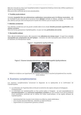© UMVF - Université Médicale Virtuelle Francophone
Elle sera mesurée au mieux par l’exophtalmométrie à l’appareil de Hertel qui donne des chiffres supérieurs à
20mm en cas d’exophtalmie.
Elle pourra être confirmée par la tomo-densitométrie.
4. Troubles oculo-moteurs
Véritable myopathie liée aux phénomènes oedèmateux musculaires puis à la fibrose musculaire , elle
se manifeste le plus souvent par la survenue d’une diplopie verticale ou oblique, variable. Les muscles les
plus atteints sont par ordre de fréquence le muscle droit inférieur puis le muscle droit médial.
5. Atteintes cornéennes
Ces atteintes cornéennes sont de gravité variable allant d’une simple kératite ponctuée superficielle à des
ulcères cornéens .
Dans les formes gravissimes d’ophtalmopathie, on peut voir des perforations de cornée .
6. Neuropathie optique
Rare, elle est extrêmement grave, elle s’associe à des altérations du champ visuel . Il s’agit d’une véritable
neuropathie par compression du nerf optique. L’évolution de cette neuropathie peut amener à la cécité
et nécessite une thérapeutique rapide.
Figure 1 : Exophtalmie dysthyroïdienne
Figure 2 : Examen tomodensitométrique d’une ophtalmopathie dysthyroïdienne
Mettant en évidence une hypertrophie des muscles oculo-moteurs touchant principalement les muscles
droits médiaux.
4. Examens complémentaires
Les examens complémentaires concernant le diagnostic de la dysthyroïdie et la confirmation de
l’ophtalmopathie :
● la confirmation de l’hyperthyroïdie se fait par la recherche des signes cliniques et biologiques
d’hyperthyroïdie ;
● la confirmation de l’ophtalmopathie se fera surtout grâce à l’imagerie : ce sont essentiellement la
tomodensitométrie ou la résonance magnétique nucléaire qui vont montrer d’une part la présence
d’une exophtalmie confirmée par la mesure de l’index oculo-orbitaire, et les signes cliniques de
l’ophtalmopathie :
○ épaississement des muscles oculo-moteurs au début au stade oedémateux
○ puis muscles devenant filiformes, rétractés au stade de fibrose
○ augmentation du compartiment graisseux orbitaire
4
 