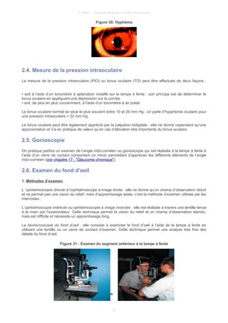 © UMVF - Université Médicale Virtuelle Francophone
Figure 30: Hyphéma
2.4. Mesure de la pression intraoculaire
La mesure de la pression intraoculaire (PIO) ou tonus oculaire (TO) peut être effectuée de deux façons :
• soit à l’aide d’un tonomètre à aplanation installé sur la lampe à fente : son principe est de déterminer le
tonus oculaire en appliquant une dépression sur la cornée.
• soit, de plus en plus couramment, à l'aide d'un tonomètre à air pulsé.
Le tonus oculaire normal se situe le plus souvent entre 10 et 20 mm Hg ; on parle d’hypertonie oculaire pour
une pression intraoculaire > 22 mm Hg.
Le tonus oculaire peut être également apprécié par la palpation bidigitale : elle ne donne cependant qu’une
approximation et n’a en pratique de valeur qu’en cas d’élévation très importante du tonus oculaire.
2.5. Gonioscopie
On pratique parfois un examen de l’angle irido-cornéen ou gonioscopie qui est réalisée à la lampe à fente à
l’aide d’un verre de contact comportant un miroir permettant d’apprécier les différents éléments de l’angle
irido-cornéen (voir chapitre 17 : "Glaucome chronique").
2.6. Examen du fond d'oeil
1. Méthodes d’examen
L ’ophtalmoscopie directe à l’ophtalmoscope à image droite : elle ne donne qu’un champ d’observation réduit
et ne permet pas une vision du relief, mais d’apprentissage aisée, c’est la méthode d’examen utilisée par les
internistes ;
L’ophtalmoscopie indirecte ou ophtalmoscopie à image inversée : elle est réalisée à travers une lentille tenue
à la main par l’examinateur. Cette technique permet la vision du relief et un champ d’observation étendu,
mais est difficile et nécessite un apprentissage long.
La biomicroscopie du fond d’oeil : elle consiste à examiner le fond d’oeil à l’aide de la lampe à fente en
utilisant une lentille ou un verre de contact d’examen. Cette technique permet une analyse très fine des
détails du fond d’oeil.
Figure 31 : Examen du segment antérieur à la lampe à fente
16
 