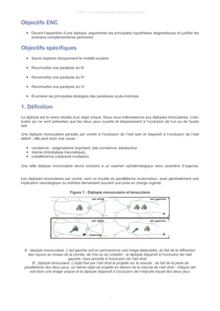 © UMVF - Université Médicale Virtuelle Francophone
Objectifs ENC
● Devant l’apparition d’une diplopie, argumenter les principales hypothèses diagnostiques et justifier les
examens complémentaires pertinents.
Objectifs spécifiques
● Savoir explorer cliniquement la motilité oculaire
● Reconnaître une paralysie du III
● Reconnaître une paralysie du IV
● Reconnaître une paralysie du VI
● Énumérer les principales étiologies des paralysies oculo-motrices.
1. Définition
La diplopie est la vision double d’un objet unique. Nous nous intéresserons aux diplopies binoculaires, c’est-
à-dire qui ne sont présentes que les deux yeux ouverts et disparaissent à l’occlusion de l’un ou de l’autre
oeil.
Une diplopie monoculaire persiste par contre à l’occlusion de l’oeil sain et disparaît à l’occlusion de l’oeil
atteint ; elle peut avoir une cause :
● cornéenne : astigmatisme important, taie cornéenne, kératocône.
● irienne (iridodialyse traumatique),
● cristallinienne (cataracte nucléaire).
Une telle diplopie monoculaire devra conduire à un examen ophtalmologique sans caractère d’urgence.
Les diplopies binoculaires par contre, sont un trouble du parallélisme oculomoteur, avec généralement une
implication neurologique ou orbitaire demandant souvent une prise en charge urgente.
Figure 1 : Diplopie monoculaire et binoculaire
A : diplopie monoculaire. L’œil gauche voit en permanence une image dédoublée, du fait de la diffraction
des rayons au niveau de la cornée, de l’iris ou du cristallin : la diplopie disparaît à l’occlusion de l’œil
gauche, mais persiste à l’occlusion de l’œil droit.
B : diplopie binoculaire. L’objet fixé par l’œil droit le projette sur la macula ; du fait de la perte de
parallélisme des deux yeux, ce même objet se projette en dehors de la macula de l’œil droit : chaque œil
voit donc une image unique et la diplopie disparaît à l’occlusion de n’importe lequel des deux yeux
3
 