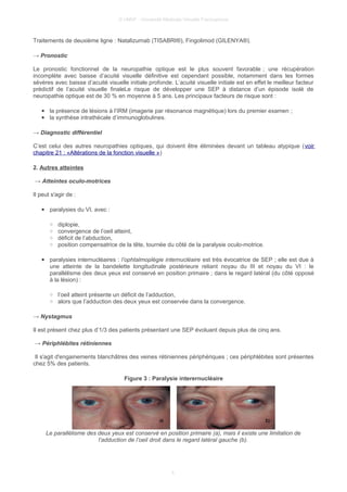 © UMVF - Université Médicale Virtuelle Francophone
Traitements de deuxième ligne : Natalizumab (TISABRI®), Fingolimod (GILENYA®).
→ Pronostic
Le pronostic fonctionnel de la neuropathie optique est le plus souvent favorable ; une récupération
incomplète avec baisse d’acuité visuelle définitive est cependant possible, notamment dans les formes
sévères avec baisse d’acuité visuelle initiale profonde. L’acuité visuelle initiale est en effet le meilleur facteur
prédictif de l’acuité visuelle finaleLe risque de développer une SEP à distance d’un épisode isolé de
neuropathie optique est de 30 % en moyenne à 5 ans. Les principaux facteurs de risque sont :
● la présence de lésions à l’IRM (imagerie par résonance magnétique) lors du premier examen ;
● la synthèse intrathécale d’immunoglobulines.
→ Diagnostic différentiel
C’est celui des autres neuropathies optiques, qui doivent être éliminées devant un tableau atypique (voir
chapitre 21 : «Altérations de la fonction visuelle »)
2. Autres atteintes
→ Atteintes oculo-motrices
Il peut s'agir de :
● paralysies du VI, avec :
○ diplopie,
○ convergence de l’oeil atteint,
○ déficit de l’abduction,
○ position compensatrice de la tête, tournée du côté de la paralysie oculo-motrice.
● paralysies internucléaires : l’ophtalmoplégie internucléaire est très évocatrice de SEP ; elle est due à
une atteinte de la bandelette longitudinale postérieure reliant noyau du III et noyau du VI : le
parallélisme des deux yeux est conservé en position primaire ; dans le regard latéral (du côté opposé
à la lésion) :
○ l’oeil atteint présente un déficit de l’adduction,
○ alors que l’adduction des deux yeux est conservée dans la convergence.
→ Nystagmus
Il est présent chez plus d’1/3 des patients présentant une SEP évoluant depuis plus de cinq ans.
→ Périphlébites rétiniennes
Il s'agit d'engainements blanchâtres des veines rétiniennes périphériques ; ces périphlébites sont présentes
chez 5% des patients.
Figure 3 : Paralysie interernucléaire
Le parallélisme des deux yeux est conservé en position primaire (a), mais il existe une limitation de
l’adduction de l’oeil droit dans le regard latéral gauche (b).
5
 