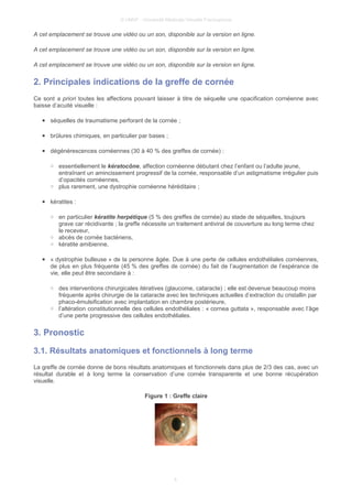 © UMVF - Université Médicale Virtuelle Francophone
A cet emplacement se trouve une vidéo ou un son, disponible sur la version en ligne.
A cet emplacement se trouve une vidéo ou un son, disponible sur la version en ligne.
A cet emplacement se trouve une vidéo ou un son, disponible sur la version en ligne.
2. Principales indications de la greffe de cornée
Ce sont a priori toutes les affections pouvant laisser à titre de séquelle une opacification cornéenne avec
baisse d’acuité visuelle :
● séquelles de traumatisme perforant de la cornée ;
● brûlures chimiques, en particulier par bases ;
● dégénérescences cornéennes (30 à 40 % des greffes de cornée) :
○ essentiellement le kératocône, affection cornéenne débutant chez l’enfant ou l’adulte jeune,
entraînant un amincissement progressif de la cornée, responsable d’un astigmatisme irrégulier puis
d’opacités cornéennes,
○ plus rarement, une dystrophie cornéenne héréditaire ;
● kératites :
○ en particulier kératite herpétique (5 % des greffes de cornée) au stade de séquelles, toujours
grave car récidivante ; la greffe nécessite un traitement antiviral de couverture au long terme chez
le receveur,
○ abcès de cornée bactériens,
○ kératite amibienne,
● « dystrophie bulleuse » de la personne âgée. Due à une perte de cellules endothéliales cornéennes,
de plus en plus fréquente (45 % des greffes de cornée) du fait de l’augmentation de l’espérance de
vie, elle peut être secondaire à :
○ des interventions chirurgicales itératives (glaucome, cataracte) ; elle est devenue beaucoup moins
fréquente après chirurgie de la cataracte avec les techniques actuelles d’extraction du cristallin par
phaco-émulsification avec implantation en chambre postérieure,
○ l’altération constitutionnelle des cellules endothéliales : « cornea guttata », responsable avec l’âge
d’une perte progressive des cellules endothéliales.
3. Pronostic
3.1. Résultats anatomiques et fonctionnels à long terme
La greffe de cornée donne de bons résultats anatomiques et fonctionnels dans plus de 2/3 des cas, avec un
résultat durable et à long terme la conservation d’une cornée transparente et une bonne récupération
visuelle.
Figure 1 : Greffe claire
4
 