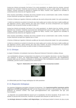 © UMVF - Université Médicale Virtuelle Francophone
Lorsqu’une chienne est gravide, les larves (4 du cycle parasitaire), en attente dans les viscères, peuvent
reprendre leur évolution. Certaines poursuivent leur développement jusqu’au stade adulte et migrent vers
l’intestin, d’autres traversent le placenta et infestent les fœtus, d’autres, enfin, gagnent les mamelles et
contamineront les chiots lors de l’ingestion de lait.
Chez d’autres mammifères, l’évolution des larves résultant de leur contamination orale s’arrête, l’évolution
ne peut reprendre qu’après leur ingestion par un chien.
L’homme s’infeste par ingestion d'aliments souillés par des œufs embryonnés (stade 5 du cycle parasitaire).
L’enfant se contamine en portant à la bouche ses mains salies par le contenu des bacs à sable souillés par
des déjections canines. Après éclosion des œufs dans l’intestin, les larves entreprennent une migration
tissulaire mais ne peuvent évoluer au-delà du stade L2.
Lorsqu’une chienne est gravide, les larves (4 du cycle parasitaire), en attente dans les viscères, peuvent
reprendre leur évolution. Certaines poursuivent leur développement jusqu’au stade adulte et migrent vers
l’intestin, d’autres traversent le placenta et infestent les fœtus, d’autres, enfin, gagnent les mamelles et
contamineront les chiots lors de l’ingestion de lait.
Chez d’autres mammifères, l’évolution des larves résultant de leur contamination orale s’arrête, l’évolution
ne peut reprendre qu’après leur ingestion par un chien.
L’homme s’infeste par ingestion d'aliments souillés par des œufs embryonnés (stade 5 du cycle parasitaire).
L’enfant se contamine en portant à la bouche ses mains salies par le contenu des bacs à sable souillés par
des déjections canines. Après éclosion des œufs dans l’intestin, les larves entreprennent une migration
tissulaire mais ne peuvent évoluer au-delà du stade L2 (impasse parasitaire).
2.1.3. Clinique
Le degré d’infestation, la localisation des larves influencent fortement l’intensité du tableau clinique.
Les manifestations cliniques correspondent à la présence et à la migration des larves. Les plus fréquentes
sont l’asthénie, la fièvre, une hépato-splénomégalie, des symptômes pulmonaires, des manifestations
cutanées telles que de l’urticaire, cardiaques ou neurologiques. Des manifestations oculaires (uvéite souvent
unilatérale), peuvent survenir à distance de la contamination.
Figure 4 : Destruction de la rétine au cours d'une toxocarose oculaire
Un infiltrat labile peut être l’image radiologique de cette parasitose.
2.1.4. Diagnostic biologique
Les examens biologiques permettent d’évoquer la toxocarose. Une hyperéosinophilie importante parfois
supérieure à 20 000 éosinophiles par mm3
est très fréquemment associée à cette parasitose. Elle diminue
lentement en plusieurs années. Une hyper gammaglobulinémie avec augmentation des IgE, peut
l'accompagner.
Le diagnostic est exceptionnellement assuré par la visualisation de larves tissulaires. Ni les œufs ni les
adultes ne peuvent être recherchés, l’évolution du parasite étant bloquée au stade de larve L2.
La sérologie demeure le meilleur outil diagnostique. Les techniques tendent à devenir de plus en plus
5
 