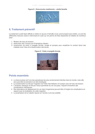 © UMVF - Université Médicale Virtuelle Francophone
Figure 8 : Dracunculus medinensis – adulte femelle
6. Traitement préventif
Le traitement curatif étant difficile à mettre en œuvre à l’échelle d’une communauté toute entière, ce sont les
différentes mesures visant à interrompre le cycle qui ont permis de faire disparaître la maladie de nombreux
pays :
1. filtration de l’eau de boisson ;
2. destruction des Cyclops par le téméphos (Abate) ;
3. construction de puits à margelle fermée, forage et pompes pour empêcher le contact direct des
malades avec l’eau et la dissémination des larves.
Figure 9 : Puits à margelle fermée
Points essentiels
● La dracunculose est l’une des parasitoses les plus anciennement décrites dans le monde, mais elle
sera peut-être la première à en être éradiquée.
● La contamination se fait par l’ingestion de l’hôte intermédiaire, le Cyclops avec de l’eau de boisson.
● L’évolution classique se fait par l’issue spontanée du ver à la peau, risquant d’entraîner des
complications infectieuses.
● Des aberrations de déplacement du ver dans l’organisme peuvent être à l’origine de complications en
rapport avec la localisation de cette migration.
● La prophylaxie de la maladie repose sur l’accès à une eau potable.
6
 