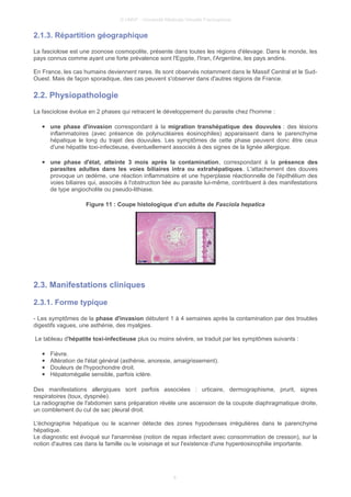 © UMVF - Université Médicale Virtuelle Francophone
2.1.3. Répartition géographique
La fasciolose est une zoonose cosmopolite, présente dans toutes les régions d'élevage. Dans le monde, les
pays connus comme ayant une forte prévalence sont l'Egypte, l'Iran, l'Argentine, les pays andins.
En France, les cas humains deviennent rares. Ils sont observés notamment dans le Massif Central et le Sud-
Ouest. Mais de façon sporadique, des cas peuvent s'observer dans d'autres régions de France.
2.2. Physiopathologie
La fasciolose évolue en 2 phases qui retracent le développement du parasite chez l'homme :
● une phase d'invasion correspondant à la migration transhépatique des douvules : des lésions
inflammatoires (avec présence de polynucléaires éosinophiles) apparaissent dans le parenchyme
hépatique le long du trajet des douvules. Les symptômes de cette phase peuvent donc être ceux
d'une hépatite toxi-infectieuse, éventuellement associés à des signes de la lignée allergique.
● une phase d'état, atteinte 3 mois après la contamination, correspondant à la présence des
parasites adultes dans les voies biliaires intra ou extrahépatiques. L'attachement des douves
provoque un œdème, une réaction inflammatoire et une hyperplasie réactionnelle de l'épithélium des
voies biliaires qui, associés à l'obstruction liée au parasite lui-même, contribuent à des manifestations
de type angiocholite ou pseudo-lithiase.
Figure 11 : Coupe histologique d’un adulte de Fasciola hepatica
2.3. Manifestations cliniques
2.3.1. Forme typique
- Les symptômes de la phase d'invasion débutent 1 à 4 semaines après la contamination par des troubles
digestifs vagues, une asthénie, des myalgies.
Le tableau d'hépatite toxi-infectieuse plus ou moins sévère, se traduit par les symptômes suivants :
● Fièvre.
● Altération de l'état général (asthénie, anorexie, amaigrissement).
● Douleurs de l'hypochondre droit.
● Hépatomégalie sensible, parfois ictère.
Des manifestations allergiques sont parfois associées : urticaire, dermographisme, prurit, signes
respiratoires (toux, dyspnée).
La radiographie de l'abdomen sans préparation révèle une ascension de la coupole diaphragmatique droite,
un comblement du cul de sac pleural droit.
L'échographie hépatique ou le scanner détecte des zones hypodenses irrégulières dans le parenchyme
hépatique.
Le diagnostic est évoqué sur l'anamnèse (notion de repas infectant avec consommation de cresson), sur la
notion d'autres cas dans la famille ou le voisinage et sur l'existence d'une hyperéosinophilie importante.
8
 