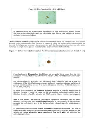 © UMVF - Université Médicale Virtuelle Francophone
Figure 16 : Œuf d’opistorchidé (40-45 x 20-30µm)
Le traitement repose sur le praziquantel (Biltricide®) à la dose de 75mg/kg/j pendant 3 jours.
Une intervention chirurgicale peut être nécessaire pour éliminer des paquets de douves
obstruant les canaux principaux.
La dicrocoeliose ou petite douve du foie est une distomatose hépatique très fréquente chez de nombreux
animaux, mais exceptionnelle chez l'homme en raison du mode de contamination (consommation de
fourmis). Il n'est pas rare cependant de retrouver des œufs de Dicrocoelium dendriticum dans les selles
humaines, en simple transit (pseudo-parasitisme lié à la consommation de foie infecté).
Figure 17 : Œuf en transit de Dicrocoelium dendriticum dans des selles humaines (40-45 x 20-30 µm)
L’agent pathogène, Dicrocoelium dendriticum, est une petite douve vivant dans les voies
biliaires de nombreux herbivores, notamment le mouton. L’hôte intermédiaire est un mollusque
terrestre.
Les métacercaires sont enkystées chez des fourmis (qui s'infestent à partir de la bave des
mollusques). L'hôte définitif s'infeste en ingérant les fourmis parasitées fixées sur les herbes (le
parasite atteint le système nerveux de la fourmi et la pousse à monter à l'extrémité des herbes
où elle reste paralysée).
Le mode de contamination par ingestion de fourmi explique le caractère exceptionnel de
l'infection humaine. Il existe de rares cas de dicrocoeliose authentique publiés dans la
littérature (troubles digestifs, altération de l'état général, fièvre, troubles neurologiques).
Mais le plus souvent, les oeufs de Dicrocoelium dendriticum découverts dans les selles
humaines correspondent à un pseudo-parasitisme lié à la consommation de foie d'animaux
parasités: les oeufs ingérés avec le foie de l'animal sont retrouvés dans les selles (oeufs en
transit).
La connaissance de la possibilité d'oeufs en transit est importante à connaître : leur mise en
évidence dans les selles impose de renouveler l'examen parasitologique des selles après une
semaine de régime alimentaire sans ingestion de foie ou de pâté, afin d’éliminer une
authentique parasitose.
12
 