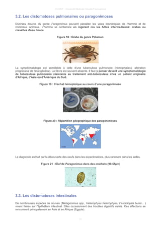 © UMVF - Université Médicale Virtuelle Francophone
3.2. Les distomatoses pulmonaires ou paragonimoses
Diverses douves du genre Paragonimus peuvent parasiter les voies bronchiques de l'homme et de
nombreux animaux. L'homme se contamine en ingérant cru les hôtes intermédiaires: crabes ou
crevettes d'eau douce.
Figure 18 : Crabe du genre Potamon
La symptomatologie est semblable à celle d'une tuberculose pulmonaire (hémoptysies), altération
progressive de l'état général). La fièvre est souvent absente. Il faut y penser devant une symptomatologie
de tuberculose pulmonaire résistante au traitement anti-tuberculeux chez un patient originaire
d'Afrique, d'Asie ou d'Amérique du Sud.
Figure 19 : Crachat hémoptoïque au cours d’une paragonimose
Figure 20 : Répartition géographique des paragonimoses
Le diagnostic est fait par la découverte des oeufs dans les expectorations, plus rarement dans les selles.
Figure 21 : Œuf de Paragonimus dans des crachats (90-55µm)
3.3. Les distomatoses intestinales
De nombreuses espèces de douves (Metagonimus spp., Heterophyes heterophyes, Fasciolopsis buski... )
vivent fixées sur l'épithélium intestinal. Elles occasionnent des troubles digestifs variés. Ces affections se
rencontrent principalement en Asie et en Afrique (Egypte).
13
 