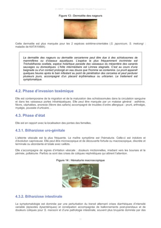 © UMVF - Université Médicale Virtuelle Francophone
Figure 13 : Dermatite des nageurs
Cette dermatite est plus marquée pour les 2 espèces extrême-orientales (S. japonicum, S. mekongi :
maladie de KATAYAMA).
La dermatite des nageurs ou dermatite cercarienne peut être due à des schistosomes de
mammifères ou d’oiseaux aquatiques. L’espèce la plus fréquemment incriminée est
Trichobilharzia ocellata, espèce holartique parasite des vaisseaux du mésentère des canards
sauvages ou domestiques. L’hôte intermédiaire est Limnea stagnalis. C’est au cours d’une
baignade ou d’un contact prolongé en eau douce que l’homme se contamine. Le prurit apparaît
quelques heures après le bain infestant au point de pénétration des cercaires et peut perdurer
plusieurs jours, accompagné d’un placard érythémateux ou urticarien. Le traitement est
symptomatique.
4.2. Phase d’invasion toxémique
Elle est contemporaine de la migration et de la maturation des schistosomules dans la circulation sanguine
et dans les vaisseaux portes intrahépatiques. Elle peut être marquée par un malaise général : asthénie,
fièvre, céphalées, anorexie (fièvre des safaris) accompagné de troubles d’ordre allergique : prurit, arthralgie,
myalgie, poussée d’urticaire…
4.3. Phase d’état
Elle est en rapport avec la localisation des pontes des femelles.
4.3.1. Bilharziose uro-génitale
L’atteinte vésicale est la plus fréquente. Le maître symptôme est l’hématurie. Celle-ci est indolore et
d’évolution capricieuse. Elle peut être microscopique et de découverte fortuite ou macroscopique, discrète et
terminale ou abondante et totale avec caillots.
Elle s’accompagne de signes d’irritation vésicale : douleurs mictionnelles, irradiant vers les bourses et le
périnée, pollakiurie. Parfois ce sont des crises de coliques néphrétiques qui attirent l’attention.
Figure 14 : Hématurie macroscopique
4.3.2. Bilharziose intestinale
La symptomatologie est dominée par une perturbation du transit alternant crises diarrhéiques d’intensité
variable (épisodes dysentériques) et constipation accompagnée de ballonnements post-prandiaux et de
douleurs coliques pour S. mansoni et d’une pathologie intestinale, souvent plus bruyante dominée par des
12
 