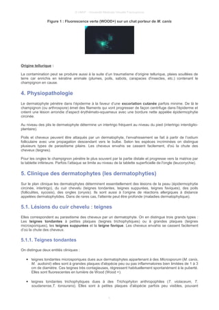 © UMVF - Université Médicale Virtuelle Francophone
Figure 1 : Fluorescence verte (WOOD+) sur un chat porteur de M. canis
Origine tellurique :
La contamination peut se produire aussi à la suite d’un traumatisme d'origine tellurique, plaies souillées de
terre car enrichis en kératine animale (plumes, poils, sabots, carapaces d'insectes, etc.) contenant le
champignon en cause.
4. Physiopathologie
Le dermatophyte pénètre dans l’épiderme à la faveur d’une excoriation cutanée parfois minime. De là le
champignon (ou arthrospore) émet des filaments qui vont progresser de façon centrifuge dans l'épiderme et
créent une lésion arrondie d'aspect érythémato-squameux avec une bordure nette appelée épidermophytie
circinée.
Au niveau des plis le dermatophyte détermine un intertrigo fréquent au niveau du pied (intertrigo interdigito-
plantaire).
Poils et cheveux peuvent être attaqués par un dermatophyte, l’envahissement se fait à partir de l’ostium
folliculaire avec une propagation descendant vers le bulbe. Selon les espèces incriminées on distingue
plusieurs types de parasitisme pilaire. Les cheveux envahis se cassent facilement, d'où la chute des
cheveux (teignes).
Pour les ongles le champignon pénètre le plus souvent par la partie distale et progresse vers la matrice par
la tablette inférieure. Parfois l’attaque se limite au niveau de la tablette superficielle de l'ongle (leuconychie).
5. Clinique des dermatophytes (les dermatophyties)
Sur le plan clinique les dermatophytes déterminent essentiellement des lésions de la peau (épidermophytie
circinée, intertrigo), du cuir chevelu (teignes tondantes, teignes suppurées, teignes faviques), des poils
(folliculites, sycosis), des ongles (onyxis). Ils sont aussi à l’origine de réactions allergiques à distance
appelées dermatophytides. Dans de rares cas, l'atteinte peut être profonde (maladies dermatophytique).
5.1. Lésions du cuir chevelu : teignes
Elles correspondent au parasitisme des cheveux par un dermatophyte. On en distingue trois grands types :
Les teignes tondantes à petites plaques (teignes trichophytiques) ou à grandes plaques (teignes
microsporiques), les teignes suppurées et la teigne favique. Les cheveux envahis se cassent facilement
d’où la chute des cheveux.
5.1.1. Teignes tondantes
On distingue deux entités cliniques :
● teignes tondantes microsporiques dues aux dermatophytes appartenant à des Microsporum (M. canis,
M. audoinii) elles sont à grandes plaques d'alopécie peu ou pas inflammatoires bien limitées de 1 à 3
cm de diamètre. Ces teignes très contagieuses, régressent habituellement spontanément à la puberté.
Elles sont fluorescentes en lumière de Wood (Wood +).
● teignes tondantes trichophytiques dues à des Trichophyton anthropophiles (T. violaceum, T.
soudanense,T. tonsurans). Elles sont à petites plaques d'alopécie parfois peu visibles, pouvant
5
 