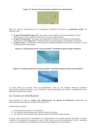 © UMVF - Université Médicale Virtuelle Francophone
Figure 14 : Examen direct squames cutanées avec arthrospores
Dans les cheveux l’envahissement du champignon permettra de préciser le parasitisme pilaire. On
distingue ainsi :
● le type trichophytique (figure 15) : les spores sont à l’intérieur du cheveu (endothrix, pas de
fluorescence), ce qui oriente d’emblée vers une origine anthropophile;
● le type microsporique : les spores sont présentes à l’intérieur et à l’extérieur (endo-ectothrix,
fluorescence verte) (figure 16) ; l'origine peut être soit anthropophile, soit géophile ou zoophile ;
● le type favique : les filaments sont uniquement intrapilaires (faible fluorescence vert-jaune), ce type
est typiquement anthropophile.
Figure 15 : Examen direct d'un cheveu parasité : Parasitisme pilaire de type endothrix
Figure 16 : Examen direct d'un cheveu parasité : Parasitisme pilaire de type ecto-endothrix
Le rendu rapide de l’examen direct est fondamental. C’est sur ces résultats (filaments mycéliens
arthrosporés, parasitisme pilaire, que le traitement anti-dermatophyte sera institué, immédiatement sans
attendre le résultat des cultures.
6.2. Culture et identification
Elle nécessite la mise en culture des prélèvements sur gélose de Sabouraud additionnée de
cycloheximide (Actidione®) et incubée entre 25 et 30°C.
L’identification reposera :
● sur le temps de pousse (1 à 3 semaines)
● sur l’examen macroscopique des cultures (couleur et texture)
● sur l’examen microscopique des cultures (aspect des filaments et des spores).
D’autres milieux favorisant la fructification et la pigmentation des cultures peuvent être utiles. La durée
moyenne d’un diagnostic mycologique à partir d’une culture pour les dermatophytes est de 3 semaines
environ. La connaissance de l’espèce permet de préciser l’origine de la contamination.
10
 