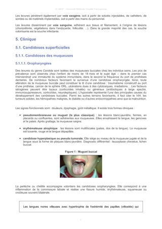 © UMVF - Université Médicale Virtuelle Francophone
Les levures pénètrent également par voie exogène, soit à partir de solutés injectables, de cathéters, de
sondes ou de matériels implantables, soit à partir des mains du personnel.
Les levures disséminent par voie sanguine, adhèrent aux tissus et filamentent, à l’origine de lésions
(choriorétinite, végétations dans l’endocarde, folliculite, ...). Dans la grande majorité des cas, la souche
colonisante est la souche infectante.
5. Clinique
5.1. Candidoses superficielles
5.1.1. Candidoses des muqueuses
5.1.1.1. Oropharyngées
Des levures du genre Candida sont isolées des muqueuses buccales chez les individus sains. Les pics de
prévalence sont observés chez l’enfant de moins de 18 mois et le sujet âgé – dans le premier cas
interviendrait une immaturité du système immunitaire, dans le second la fréquence du port de prothèses
dentaires. De nombreux facteurs favorisent la survenue d’une candidose oropharyngée. Ainsi, toute
altération de la muqueuse buccale peut constituer le lit d’une candidose : traumatisme consécutif au port
d’une prothèse, cancer de la sphère ORL, ulcérations dues à des cytotoxiques, irradiations… Les facteurs
iatrogènes peuvent être locaux (corticoïdes inhalés) ou généraux (antibiotiques à large spectre,
immunosuppresseurs, corticoïdes, neuroleptiques). L’hyposialie représente l’une des principales causes du
développement des candidoses buccales. Parmi les autres terrains favorisants, il faut citer le VIH, les
tumeurs solides, les hémopathies malignes, le diabète ou d’autres endocrinopathies ainsi que la malnutrition.
Les signes fonctionnels sont : douleurs, dysphagie, goût métallique. Il existe trois formes cliniques :
● pseudomembraneuse ou muguet (la plus classique) : les lésions blanc-jaunâtre, fermes, en
placards ou confluentes, sont adhérentes aux muqueuses. Elles envahissent la langue, les gencives
et le palais. Après grattage, la muqueuse saigne.
● érythémateuse atrophique : les lésions sont multifocales (palais, dos de la langue). La muqueuse
est luisante, rouge et la langue dépapillée.
● candidose hyperplasique ou pseudo tumorale. Elle siège au niveau de la muqueuse jugale et de la
langue sous la forme de plaques blanc-jaunâtre. Diagnostic différentiel : leucoplasie chevelue, lichen
buccal.
Figure 1 : Muguet buccal
La perlèche ou chéilite accompagne volontiers les candidoses oropharyngées. Elle correspond à une
inflammation de la commissure labiale et réalise une fissure humide, érythémateuse, squameuse ou
croûteuse souvent bilatérale.
Les langues noires villeuses avec hypertrophie de l'extrémité des papilles (villosités) qui
7
 