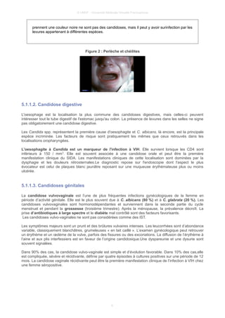 © UMVF - Université Médicale Virtuelle Francophone
prennent une couleur noire ne sont pas des candidoses, mais il peut y avoir surinfection par les
levures appartenant à différentes espèces.
Figure 2 : Perlèche et chéilites
5.1.1.2. Candidose digestive
L'oesophage est la localisation la plus commune des candidoses digestives, mais celles-ci peuvent
intéresser tout le tube digestif de l'estomac jusqu'au colon. La présence de levures dans les selles ne signe
pas obligatoirement une candidose digestive.
Les Candida spp. représentent la première cause d'oesophagite et C. albicans, là encore, est la principale
espèce incriminée. Les facteurs de risque sont pratiquement les mêmes que ceux retrouvés dans les
localisations oropharyngées.
L'oesophagite à Candida est un marqueur de l'infection à VIH. Elle survient lorsque les CD4 sont
inférieurs à 150 / mm3
. Elle est souvent associée à une candidose orale et peut être la première
manifestation clinique du SIDA. Les manifestations cliniques de cette localisation sont dominées par la
dysphagie et les douleurs rétrosternales.Le diagnostic repose sur l'endoscopie dont l'aspect le plus
évocateur est celui de plaques blanc jaunâtre reposant sur une muqueuse érythémateuse plus ou moins
ulcérée.
5.1.1.3. Candidoses génitales
La candidose vulvovaginale est l’une de plus fréquentes infections gynécologiques de la femme en
période d’activité génitale. Elle est le plus souvent due à C. albicans (80 %) et à C. glabrata (20 %). Les
candidoses vulvovaginales sont hormonodépendantes et surviennent dans la seconde partie du cycle
menstruel et pendant la grossesse (troisième trimestre). Après la ménopause, la prévalence décroît. La
prise d’antibiotiques à large spectre et le diabète mal contrôlé sont des facteurs favorisants.
Les candidoses vulvo-vaginales ne sont pas considérées comme des IST.
Les symptômes majeurs sont un prurit et des brûlures vulvaires intenses. Les leucorrhées sont d’abondance
variable, classiquement blanchâtres, grumeleuses « en lait caillé ». L’examen gynécologique peut retrouver
un érythème et un œdème de la vulve, parfois des fissures ou des excoriations. La diffusion de l’érythème à
l’aine et aux plis interfessiers est en faveur de l’origine candidosique.Une dyspareunie et une dysurie sont
souvent signalées.
Dans 90% des cas, la candidose vulvo-vaginale est simple et d’évolution favorable. Dans 10% des cas,elle
est compliquée, sévère et récidivante, définie par quatre épisodes à cultures positives sur une période de 12
mois. La candidose vaginale récidivante peut être la première manifestation clinique de l’infection à VIH chez
une femme séropositive.
8
 