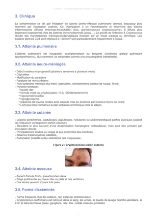 © UMVF - Université Médicale Virtuelle Francophone
3. Clinique
La contamination se fait par inhalation de spores (primo-infection pulmonaire latente), beaucoup plus
rarement par inoculation cutanée. Ce champignon a un neurotropisme et détermine des lésions
inflammatoires diffuses (méningo-éncephalite) et/ou granulomateuse (cryptococcome). Il diffuse plus
largement (septicémie) chez les patients immunodéprimés (peau…). La gravité de l'infection à Cryptococcus
résulte des manifestations méningo-encéphalitiques évoluant sur un mode subaigu ou chronique. Les
sidéens dont les CD4 sont inférieurs à 100 mm3
sont particulièrement fréquemment à risque.
3.1. Atteinte pulmonaire
L'atteinte pulmonaire est inaugurale, asymptomatique ou bruyante (syndrome grippal guérissant
spontanément ou, plus rarement, se présentant comme une pneumopathie interstitielle).
3.2. Atteinte neuro-méningée
- Début insidieux et progressif (plusieurs semaines à plusieurs mois)
- Céphalées
- Modification du caractère
- Paralysie de nerfs crâniens
- Puis syndrome méningé plus franc (céphalées, vomissements, raideur de nuque, fièvre)
- Ponction lombaire :
* liquide clair
* formule mixte ou lymphocytaire (10 à 100/éléments/mm3)
* hyperprotéinorachie
* hypoglycorachie
* présence de levures rondes avec capsule mise en évidence par le test à l'encre de Chine
* LCR peut être normal sur le plan cellulaire et chimique chez le sidéen.
3.3. Atteinte cutanée
- Lésions acnéiformes, pustuleuses, papuleuses, nodulaires ou ulcéronécrotiques parfois atypiques (aspect
de molluscum contagiosum parfois observé).
- Résultent le plus souvent d'une dissémination hématogène (métastases), mais peut être primaire par
inoculation directe.
- Principalement situées au visage et aux extrémités des membres,
- Absence d'adénopathies satellites,
- Association possible à des ulcérations des muqueuses..
Figure 2 : Cryptococcose lésion cutanée
3.4. Atteinte osseuse
- Aspect d'abcès froids, pseudo-tuberculeux
- Siège préférentiel au niveau des os plats et des vertèbres
- Ces abcès peuvent s'ouvrir à la peau.
3.5. Forme disséminée
- Forme fréquente chez les sidéens, non traité par antirétroviraux.
- Cryptococcus neoformans est retrouvé dans le sang, les urines, le liquide de lavage broncho-alvéolaire, le
LCR et dans les tissus (peau, ganglions, rate, foie, moelle osseuse, prostate).
5
 