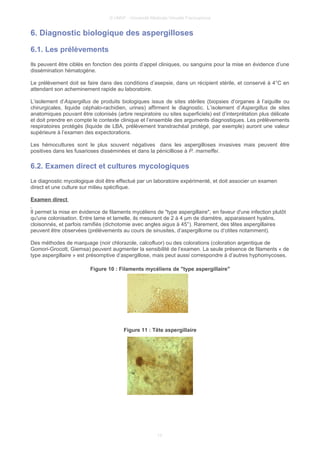 © UMVF - Université Médicale Virtuelle Francophone
6. Diagnostic biologique des aspergilloses
6.1. Les prélèvements
Ils peuvent être ciblés en fonction des points d’appel cliniques, ou sanguins pour la mise en évidence d’une
dissémination hématogène.
Le prélèvement doit se faire dans des conditions d’asepsie, dans un récipient stérile, et conservé à 4°C en
attendant son acheminement rapide au laboratoire.
L’isolement d’Aspergillus de produits biologiques issus de sites stériles (biopsies d’organes à l’aiguille ou
chirurgicales, liquide céphalo-rachidien, urines) affirment le diagnostic. L’isolement d’Aspergillus de sites
anatomiques pouvant être colonisés (arbre respiratoire ou sites superficiels) est d’interprétation plus délicate
et doit prendre en compte le contexte clinique et l’ensemble des arguments diagnostiques. Les prélèvements
respiratoires protégés (liquide de LBA, prélèvement transtrachéal protégé, par exemple) auront une valeur
supérieure à l’examen des expectorations.
Les hémocultures sont le plus souvent négatives dans les aspergilloses invasives mais peuvent être
positives dans les fusarioses disséminées et dans la pénicilliose à P. marneffei.
6.2. Examen direct et cultures mycologiques
Le diagnostic mycologique doit être effectué par un laboratoire expérimenté, et doit associer un examen
direct et une culture sur milieu spécifique.
Examen direct
Il permet la mise en évidence de filaments mycéliens de "type aspergillaire", en faveur d'une infection plutôt
qu'une colonisation. Entre lame et lamelle, ils mesurent de 2 à 4 µm de diamètre, apparaissent hyalins,
cloisonnés, et parfois ramifiés (dichotomie avec angles aigus à 45°). Rarement, des têtes aspergillaires
peuvent être observées (prélèvements au cours de sinusites, d’aspergillome ou d’otites notamment).
Des méthodes de marquage (noir chlorazole, calcofluor) ou des colorations (coloration argentique de
Gomori-Grocott, Giemsa) peuvent augmenter la sensibilité de l’examen. La seule présence de filaments « de
type aspergillaire » est présomptive d’aspergillose, mais peut aussi correspondre à d’autres hyphomycoses.
Figure 10 : Filaments mycéliens de "type aspergillaire"
Figure 11 : Tête aspergillaire
13
 