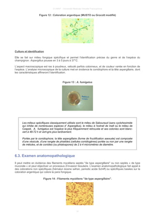 © UMVF - Université Médicale Virtuelle Francophone
Figure 12 : Coloration argentique (MUSTO ou Grocott modifié)
Culture et identification
Elle se fait sur milieu fongique spécifique et permet l’identification précise du genre et de l’espèce du
champignon. Aspergillus pousse en 3 à 5 jours à 37°C.
L’aspect macroscopique est ras à poudreux, velouté parfois cotonneux, et de couleur variée en fonction de
l’espèce. L’analyse microscopique de la culture met en évidence le conidiophore et la tête aspergillaire, dont
les caractéristiques affineront l’identification.
Figure 13 : A. fumigatus
Les milieux spécifiques classiquement utilisés sont le milieu de Sabouraud (sans cycloheximide
qui inhibe de nombreuses espèces d’ Aspergillus), le milieu à l’extrait de malt ou le milieu de
Czapek. A. fumigatus est l’espèce la plus fréquemment retrouvée et ses colonies sont blanc-
vert à 48-72 h et vert-gris plus tardivement.
Portée par le conidiophore, la tête aspergillaire (forme de fructification asexuée) est composée
d’une vésicule, d’une rangée de phialides (cellules conidiogènes) portée ou non par une rangée
de métules, et de conidies (ou phialospores) de 2 à 4 micromètres de diamètre.
6.3. Examen anatomopathologique
Il peut mettre en évidence des filaments mycéliens septés "de type aspergillaire" ou non septés « de type
mucorale » et peut objectiver un processus d’invasion tissulaire. L'examen anatomopathologique fait appel à
des colorations non spécifiques (hémalun éosine safran, periodic acide Schiff) ou spécifiques basées sur la
coloration argentique qui colore la paroi fongique.
Figure 14 : Filaments mycéliens "de type aspergillaire".
14
 