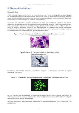 © UMVF - Université Médicale Virtuelle Francophone
8. Diagnostic biologique
Diagnostic direct
P. jirovecii est principalement recherché au niveau des poumons. L’étude du lavage bronchiolo-alvéolaire
est le meilleur examen pour sa détection. Celle des crachats induits ou des lavages oropharyngés, bien que
moins sensible, peut être proposée en cas de contre-indications au lavage bronchioloalvéolaire. La biopsie
transpariétale ou transbronchique est rarement usitée en France.
P. jirovecii est recherché à l’examen microscopique direct après coloration spécifique des produits
biologiques: technique argentique rapide de Musto qui colore bien la paroi des kystes regroupés en amas ;
le bleu de toluidine présente les mêmes avantages. La colonisation de Giemsa est indispensable pour
mettre en évidence les formes trophiques non observées avec les colorations précédentes. Elle permet
aussi de visualiser les corps intrakystiques (au nombre de 8 maximum, disposées en rosette), et les amas
spumeux contenant les formes trophiques, les prékystes et les kystes.
Figure 8 : Trophozoïtes et kystes de P. jirovecii colorés au Giemsa dans un LBA
Figure 9 : Kystes de P. jirovecii colorés au Musto dans un LBA
Par ailleurs, des anticorps monoclonaux spécifiques marqués à la fluorescéine permettent de repérer
aisément le champignon.
Figure 10 : Kystes de P. jirovecii fluorescents par monoclonaux spécifiques dans un LBA
La PCR peut être utile au diagnostic surtout en cas de pauci-infection, mais ne permet pas toujours de
différencier les porteurs sains des vrais malades. Elle permet d’augmenter la sensibilité de l’examen à partir
des crachats ou des lavages oropharyngés.
La culture mycologique des prélèvements respiratoires est constamment négative car ce champignon n’est
pas cultivable.
8
 