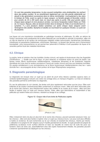 © UMVF - Université Médicale Virtuelle Francophone
Ce sont des parasites temporaires, le plus souvent endophiles voire pholéophiles (se cachent
dans des petites cavités). Ils se caractérisent également par une très grande sédentarité qui
aboutit à des générations successives dans le même microhabitat. L’accouplement a lieu dans
le biotope de l’hôte, avant ou après le repas sanguin. La femelle gorgée et fécondée s’abrite
pour pondre de 20 à 200 œufs mais ne meurt pas après la ponte. Elle peut pondre après
chaque repas sanguin et vivre plusieurs années. Les larves hexapodes restent fixées sur l’hôte
de 2 à 5 jours. Repues, elles se laissent tomber dans le biotope de l’hôte et se transforment en
nymphes. Il y aura plusieurs stades nymphaux (un après chaque repas sanguin) avant
l’émergence des adultes. Nymphes et adultes se nourrissent en quelques minutes. Le cycle est
dit polyxène.
Les tiques ont une importance considérable en pathologie humaine et vétérinaire. En effet, en dehors de
l’action neurotrope voire paralysante de la salive élaborée par une femelle en période d’oviposition, elles ont
un rôle de réservoir et de vecteur de nombreuses maladies virales (arboviroses), bactériennes (borrélioses,
rickettioses) et parasitaires (babésioses, ehrlichioses, filarioses). La plupart des germes sont à transmission
transtadiale, voire transovarienne ce qui permet leur pérennité à l’intérieur d’une population de tiques et le
caractère parfois focal des maladies transmises.
4.2. Clinique
La piqûre, lente et indolore chez les Ixodidés (Ixodes ricinus), est rapide et douloureuse chez les Argasidés
(Ornithodorus….). Quelle que soit la tique, on peut observer un érythème autour du point de piqûre. Les
taches noires (fièvre boutonneuse méditerranéenne, rickettsiose africaines) et les érythèmes migrants
(borréliose de Lyme dont le vecteur principal en France est Ixodes ricinus) sont dus aux bactéries inoculées.
On assiste actuellement à une recrudescence de la fièvre boutonneuse méditerranéenne chez les « sans
domicile fixe » accompagnés de leur chien porteur de la tique Rhipicephalus sanguineus.
5. Diagnostic parasitologique
Le diagnostic est évoqué chez un sujet qui se plaint de prurit et/ou lésions cutanées apparus dans un
contexte épidémiologique incluant une notion de contage et/ou un manque d’hygiène. La mise en évidence
des parasites permet la confirmation du diagnostic.
En cas de pédiculose du cuir chevelu, les lentes sont plus rapidement retrouvées que les poux. Elles sont
brillantes et de couleur caramel lorsqu’elles contiennent un embryon vivant ; elles sont alors retrouvées près
de la racine des cheveux, plus fréquemment autour des oreilles et au niveau de la nuque ; elles sont plus
faciles à repérer chez un sujet aux cheveux blonds. Vides, elles sont blanchâtres et ressemblent à des
pellicules qui restent fixées aux cheveux, résistant au lavage et au coiffage.
Figure 12 : Coque vide d’une lente de Pediculus capitis
(Photo A. Izri)
Elles s’observent alors de plus en plus loin de la racine des cheveux, pouvant persister plusieurs mois, sur
les cheveux ; elles sont plus faciles à repérer chez un sujet aux cheveux bruns. Les poux sont plus difficiles
à mettre en évidence. Ils sont recherchés sur le cuir chevelu en écartant les cheveux, mèche par mèche.
L’utilisation d’un peigne fin (dit "peigne à poux") facilite grandement la récolte : le sujet parasité est peigné de
préférence au-dessus d’une surface blanche et lisse sur laquelle se voient tout de suite les poux qui
tombent. Dans de rares cas, essentiellement chez des sujets massivement infestés, les parasites peuvent
s’observer spontanément se déplaçant sur les cheveux.
9
 