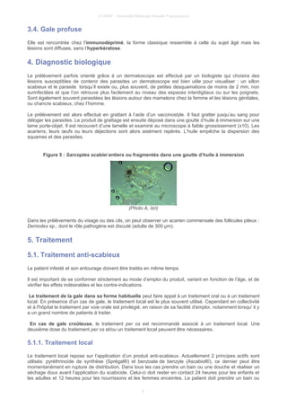 © UMVF - Université Médicale Virtuelle Francophone
3.4. Gale profuse
Elle est rencontrée chez l'immunodéprimé, la forme classique ressemble à celle du sujet âgé mais les
lésions sont diffuses, sans l’hyperkératose.
4. Diagnostic biologique
Le prélèvement parfois orienté grâce à un dermatoscope est effectué par un biologiste qui choisira des
lésions susceptibles de contenir des parasites un dermatoscope est bien utile pour visualiser : un sillon
scabieux et le parasite lorsqu’il existe ou, plus souvent, de petites desquamations de moins de 2 mm, non
surinfectées et que l’on retrouve plus facilement au niveau des espaces interdigitaux ou sur les poignets.
Sont également souvent parasitées les lésions autour des mamelons chez la femme et les lésions génitales,
ou chancre scabieux, chez l’homme.
Le prélèvement est alors effectué en grattant à l’aide d’un vaccinostyle. Il faut gratter jusqu’au sang pour
déloger les parasites. Le produit de grattage est ensuite déposé dans une goutte d’huile à immersion sur une
lame porte-objet. Il est recouvert d’une lamelle et examiné au microscope à faible grossissement (x10). Les
acariens, leurs œufs ou leurs déjections sont alors aisément repérés. L’huile empêche la dispersion des
squames et des parasites.
Figure 5 : Sarcoptes scabiei entiers ou fragmentés dans une goutte d’huile à immersion
(Photo A. Izri)
Dans les prélèvements du visage ou des cils, on peut observer un acarien commensale des follicules pileux :
Demodex sp., dont le rôle pathogène est discuté (adulte de 300 μm).
5. Traitement
5.1. Traitement anti-scabieux
Le patient infesté et son entourage doivent être traités en même temps.
Il est important de se conformer strictement au mode d’emploi du produit, variant en fonction de l’âge, et de
vérifier les effets indésirables et les contre-indications.
Le traitement de la gale dans sa forme habituelle peut faire appel à un traitement oral ou à un traitement
local. En présence d'un cas de gale, le traitement local est le plus souvent utilisé. Cependant en collectivité
et à l'hôpital le traitement par voie orale est privilégié, en raison de sa facilité d'emploi, notamment lorsqu' il y
a un grand nombre de patients à traiter.
En cas de gale croûteuse, le traitement per os est recommandé associé à un traitement local. Une
deuxième dose du traitement per os et/ou un traitement local peuvent être nécessaires.
5.1.1. Traitement local
Le traitement local repose sur l’application d’un produit anti-scabieux. Actuellement 2 principes actifs sont
utilisés: pyréthrinoïde de synthèse (Sprégal®) et benzoate de benzyle (Ascabiol®), ce dernier peut être
momentanément en rupture de distribution. Dans tous les cas prendre un bain ou une douche et réaliser un
séchage doux avant l’application du scabicide. Celui-ci doit rester en contact 24 heures pour les enfants et
les adultes et 12 heures pour les nourrissons et les femmes enceintes. Le patient doit prendre un bain ou
6
 