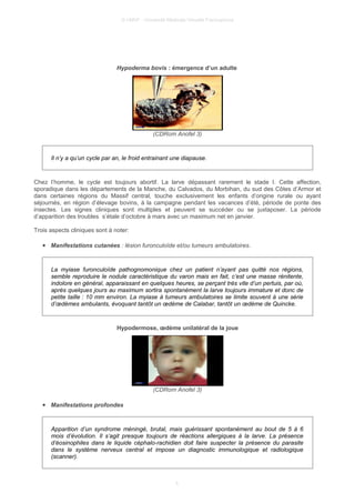 © UMVF - Université Médicale Virtuelle Francophone
Hypoderma bovis : émergence d’un adulte
(CDRom Anofel 3)
Il n’y a qu’un cycle par an, le froid entrainant une diapause.
Chez l’homme, le cycle est toujours abortif. La larve dépassant rarement le stade I. Cette affection,
sporadique dans les départements de la Manche, du Calvados, du Morbihan, du sud des Côtes d’Armor et
dans certaines régions du Massif central, touche exclusivement les enfants d’origine rurale ou ayant
séjournés, en région d’élevage bovins, à la campagne pendant les vacances d’été, période de ponte des
insectes. Les signes cliniques sont multiples et peuvent se succéder ou se juxtaposer. La période
d’apparition des troubles s’étale d’octobre à mars avec un maximum net en janvier.
Trois aspects cliniques sont à noter:
● Manifestations cutanées : lésion furonculoïde et/ou tumeurs ambulatoires.
La myiase furonculoïde pathognomonique chez un patient n’ayant pas quitté nos régions,
semble reproduire le nodule caractéristique du varon mais en fait, c’est une masse rénitente,
indolore en général, apparaissant en quelques heures, se perçant très vite d’un pertuis, par où,
après quelques jours au maximum sortira spontanément la larve toujours immature et donc de
petite taille : 10 mm environ. La myiase à tumeurs ambulatoires se limite souvent à une série
d’œdèmes ambulants, évoquant tantôt un œdème de Calabar, tantôt un œdème de Quincke.
Hypodermose, œdème unilatéral de la joue
(CDRom Anofel 3)
● Manifestations profondes
Apparition d’un syndrome méningé, brutal, mais guérissant spontanément au bout de 5 à 6
mois d’évolution. Il s’agit presque toujours de réactions allergiques à la larve. La présence
d’éosinophiles dans le liquide céphalo-rachidien doit faire suspecter la présence du parasite
dans le système nerveux central et impose un diagnostic immunologique et radiologique
(scanner).
5
 