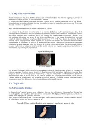 © UMVF - Université Médicale Virtuelle Francophone
1.2.3. Myiases accidentelles
De très nombreuses mouches, dont les larves vivent normalement dans des matières organiques, en voie de
putréfaction ou non, peuvent se rencontrer chez l’homme.
Le plus souvent il s’agira de mouches à biologie « indécise » ou à vocation parasitaire encore mal définie :
les asticots se rencontreront aussi bien sur des cadavres que sur des plaies d’animaux, ou d’hommes,
blessés, comateux ou grabataires.
Nous citerons essentiellement les genres classiques en Europe :
Les asticots de Lucilia spp. (mouche verte de la viande), Calliphora erythrocephala (mouche bleu de la
viande) et Musca domestica (mouche domestique) sont fréquents sur les substances alimentaires avariées
(viande par exemple). Ils occasionnent surtout des myiases des plaies (plaies traumatiques : accident de la
voie publique, blessures par armes à feu ou armes blanches, … ou plaies ulcéreuses) au pronostic
excellent, rappelons d’ailleurs l’emploi pendant la guerre de 1914-1918 d’une Lucilia (L. sericata) dont les
asticots, élevés aseptiquement, étaient déposés sur les plaies des blessés, et supprimant sélectivement les
chairs mortes, ils nettoyaient la blessure et accéléraient la guérison. Des asticots de Musca ont parfois été
extraits de la cavité vaginale, chez des femmes à hygiène intime rudimentaire. De nombreuses espèces
peuvent également se retrouver dans le conduit auditif externe, ces myiases vaginales et auriculaires se
manifestent uniquement par un prurit local.
Figute 5 : Otomyiase
(CDRom Anofel 3)
Les larves d’Eristalis et de Fannia ont une morphologie typique et vivent dans les substances chargées en
matière organique (tinettes, fosses à purin…). Ces larves ont été signalées, à plusieurs reprises, dans
l’ampoule rectale de l’homme (myiases intestinales). La mouche vient pondre à l’orifice de l’anus. Les larves
remontent alors dans le rectum voire le bas colon et glissent leur long siphon respiratoire d’où le nom de
« vers à queue de rat » entre les plis radiés de l’anus pour respirer. Le malade consulte pour des douleurs
vagues accompagnées d’épisodes diarrhéiques et de sensation de gêne anale.
1.3. Diagnostic
1.3.1. Diagnostic clinique
Le diagnostic de "myiase" au sens large est évident si un ou des asticots sont visibles au fond d’un pertuis,
ou sont apportés par le patient. Dans ce dernier cas toutefois il faut pousser l’interrogatoire pour éviter de
tomber dans le piège d’un syndrome d’Ekbom.
Dans le cas d’une myiase rectale, l’examen des selles par le patient peut livrer la clé des problèmes digestifs
de celui-ci avec le rejet des "larves à queue de rat".
Figure 6 : Myiase rectale : Eristalis tenax au stade 3 ou « larve à queue de rat »
(CDRom Anofel 3)
9
 