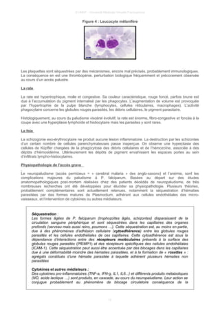 © UMVF - Université Médicale Virtuelle Francophone
Figure 4 : Leucocyte mélanifère
Les plaquettes sont séquestrées par des mécanismes, encore mal précisés, probablement immunologiques.
La conséquence en est une thrombopénie, perturbation biologique fréquemment et précocement observée
au cours d’un accès palustre.
La rate
La rate est hypertrophique, molle et congestive. Sa couleur caractéristique, rouge foncé, parfois brune est
due à l’accumulation du pigment internalisé par les phagocytes. L’augmentation de volume est provoquée
par l’hypertrophie de la pulpe blanche (lymphocytes, cellules réticulaires, macrophages). L’activité
phagocytaire concerne les globules rouges parasités, les débris cellulaires, le pigment parasitaire.
Histologiquement, au cours du paludisme viscéral évolutif, la rate est énorme, fibro-congestive et foncée à la
coupe avec une hyperplasie lymphoïde et histiocytaire mais les parasites y sont rares.
Le foie
La schizogonie exo-érythrocytaire ne produit aucune lésion inflammatoire. La destruction par les schizontes
d’un certain nombre de cellules parenchymateuses passe inaperçue. On observe une hyperplasie des
cellules de Küpffer chargées de la phagocytose des débris cellulaires et de l’hémozoïne, associée à des
dépôts d’hémosidérine. Ultérieurement les dépôts de pigment envahissent les espaces portes au sein
d’infiltrats lympho-histiocytaires.
Physiopathologie de l'accès grave
Le neuropaludisme (accès pernicieux = « cerebral malaria » des anglo-saxons) et l’anémie, sont les
complications majeures du paludisme à P. falciparum. Basées au départ sur des études
anatomopathologiques post-mortem réalisées chez des patients décédés de neuropaludisme, de très
nombreuses recherches ont été développées pour élucider sa physiopathologie. Plusieurs théories,
probablement complémentaires sont actuellement retenues, notamment la séquestration d’hématies
parasitées par des formes matures de Plasmodium, adhérant aux cellules endothéliales des micro-
vaisseaux, et l’intervention de cytokines ou autres médiateurs.
Séquestration :
Les formes âgées de P. falciparum (trophozoïtes âgés, schizontes) disparaissent de la
circulation sanguine périphérique et sont séquestrées dans les capillaires des organes
profonds (cerveau mais aussi reins, poumons …). Cette séquestration est, au moins en partie,
due à des phénomènes d’adhésion cellulaire (cytoadhérence) entre les globules rouges
parasités et les cellules endothéliales de ces capillaires. Cette cytoadhérence est sous la
dépendance d’interactions entre des récepteurs moléculaires présents à la surface des
globules rouges parasités (PfEMP1) et des récepteurs spécifiques des cellules endothéliales
(ICAM-1). Cette séquestration peut aussi être accentuée par des blocages dans les capillaires
due à une déformabilité moindre des hématies parasitées, et à la formation de « rosettes » :
agrégats constitués d’une hématie parasitée à laquelle adhèrent plusieurs hématies non
parasitées
Cytokines et autres médiateurs :
Des cytokines pro-inflammatoires (TNF-a, IFN-g, IL1, IL6...) et différents produits métaboliques
(NO, acide lactique …) sont produits, en cascade, au cours du neuropaludisme. Leur action se
conjugue probablement au phénomène de blocage circulatoire conséquence de la
12
 