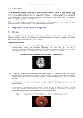© UMVF - Université Médicale Virtuelle Francophone
6.3. Traitement
La toxoplasmose acquise postnatale du sujet immunocompétent guérit le plus souvent sans
traitement. En cas d’asthénie importante le traitement classique associe la spiramycine (Rovamycine®, 1,5
MUI/10 kg par jour en pédiatrie, 6 à 9 MUI par jour chez l’adulte) à l’acide ascorbique (1 g/j) pendant un
mois. L’association trimethoprime-sulfamethoxazole est certainement plus efficace mais il y a peu de
données bibliographiques dans cette indication.
Seules les rares formes graves dues à des souches virulentes justifient un traitement plus puissant identique
à celui prescrit chez l’immunodéprimé. Cette décision relève du spécialiste.
7. Toxoplasmose de l’immunodéprimé
7.1. Clinique
C’est une maladie grave, constamment mortelle sans traitement sauf les formes oculaires isolées qui
peuvent conduire à la cécité. Les descriptions classiques distinguent les formes localisées et les formes
disséminées mais la réalité est souvent moins tranchée.
Toxoplasmose localisée :
● La localisation la plus fréquente est cérébrale (figure 4) ; le tableau clinique est celui d’un abcès. La
symptomatologie associe des céphalées persistantes, une fièvre dans 50% des cas et
secondairement un déficit focalisé en rapport avec la localisation du ou des abcès. Une crise comitiale
inaugurale est possible. La révélation sous forme d’une crise comitiale est fréquente.
Figure 4 : Toxoplasmose de l ’immunodéprimé : Abcès cérébral
● La seconde localisation la plus fréquente est oculaire (figure 5). Le patient se plaint d’une baisse
d’acuité visuelle, d’impression de « mouches volantes » et d’une rougeur oculaire. Le diagnostic est
ophtalmologique. Au cours de l’infection par le VIH une localisation cérébrale est associée dans 40%
des cas.
● La toxoplasmose pulmonaire se traduit par une pneumopathie fébrile dyspnéisante évoquant la
pneumocystose.
● Le tachyzoïte de T. gondii pouvant pénétrer dans n’importe quel type de cellules, la littérature est riche
de cas rapportés dans les localisations les plus diverses, le diagnostic étant apporté par l’examen
anatomo-pathologique, l’inoculation à l’animal ou la biologie moléculaire.
Figure 5 : Toxoplasmose de l’immunodéprimé : Choriorétinite toxoplasmique
10
 