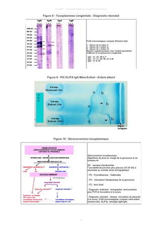 © UMVF - Université Médicale Virtuelle Francophone
Figure 8 : Toxoplasmose congénitale : Diagnostic néonatal
Figure 9 : PIC ELIFA IgG Mère-Enfant - Enfant atteint
Figure 10 : Séroconversion toxoplasmique
15
 