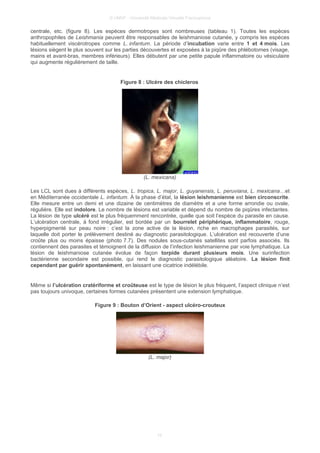 © UMVF - Université Médicale Virtuelle Francophone
centrale, etc. (figure 8). Les espèces dermotropes sont nombreuses (tableau 1). Toutes les espèces
anthropophiles de Leishmania peuvent être responsables de leishmaniose cutanée, y compris les espèces
habituellement viscérotropes comme L. infantum. La période d’incubation varie entre 1 et 4 mois. Les
lésions siègent le plus souvent sur les parties découvertes et exposées à la piqûre des phlébotomes (visage,
mains et avant-bras, membres inférieurs). Elles débutent par une petite papule inflammatoire ou vésiculaire
qui augmente régulièrement de taille.
Figure 8 : Ulcère des chicleros
(L. mexicana)
Les LCL sont dues à différents espèces, L. tropica, L. major, L. guyanensis, L. peruviana, L. mexicana…et
en Méditerranée occidentale L. infantum. À la phase d’état, la lésion leishmanienne est bien circonscrite.
Elle mesure entre un demi et une dizaine de centimètres de diamètre et a une forme arrondie ou ovale,
régulière. Elle est indolore. Le nombre de lésions est variable et dépend du nombre de piqûres infectantes.
La lésion de type ulcéré est le plus fréquemment rencontrée, quelle que soit l’espèce du parasite en cause.
L’ulcération centrale, à fond irrégulier, est bordée par un bourrelet périphérique, inflammatoire, rouge,
hyperpigmenté sur peau noire : c’est la zone active de la lésion, riche en macrophages parasités, sur
laquelle doit porter le prélèvement destiné au diagnostic parasitologique. L’ulcération est recouverte d’une
croûte plus ou moins épaisse (photo 7.7). Des nodules sous-cutanés satellites sont parfois associés. Ils
contiennent des parasites et témoignent de la diffusion de l’infection leishmanienne par voie lymphatique. La
lésion de leishmaniose cutanée évolue de façon torpide durant plusieurs mois. Une surinfection
bactérienne secondaire est possible, qui rend le diagnostic parasitologique aléatoire. La lésion finit
cependant par guérir spontanément, en laissant une cicatrice indélébile.
Même si l’ulcération cratériforme et croûteuse est le type de lésion le plus fréquent, l’aspect clinique n’est
pas toujours univoque, certaines formes cutanées présentent une extension lymphatique.
Figure 9 : Bouton d’Orient - aspect ulcéro-crouteux
(L. major)
10
 