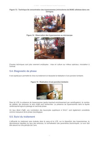 © UMVF - Université Médicale Virtuelle Francophone
Figure 13 : Technique de concentration des trypanosomes (minicolonne de DEAE cellulose dans une
seringue)
Figure 14 : Observation des trypanosomes au microscope
D’autres techniques sont plus rarement employées : mise en culture sur milieux spéciaux, inoculation à
l’animal.
5.4. Diagnostic de phase
Il est capital pour permettre le choix du traitement et nécessite la réalisation d’une ponction lombaire.
Figure 15 : Réalisation d’une ponction lombaire
Dans le LCR, la présence de trypanosomes (après éventuel enrichissement par centrifugation), le nombre
de cellules, les anticorps, le taux d’IgM sont recherchés. La présence de trypanosomes dans le liquide
cérébrospinal signe le passage en seconde phase.
Un taux élevé d’IgM, une numération des leucocytes supérieure à 5/mm3
, sont également considérés
comme marqueurs de la phase neurologique.
5.5. Suivi du traitement
L’efficacité du traitement sera évaluée dans le sang et le LCR, sur la disparition des trypanosomes, la
décroissance régulière du taux des anticorps, la normalisation des paramètres biochimiques. Le suivi doit
être assuré sur une période de 2 ans.
10
 