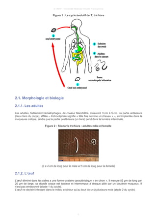 © UMVF - Université Médicale Virtuelle Francophone
Figure 1 : Le cycle évolutif de T. trichiura
2.1. Morphologie et biologie
2.1.1. Les adultes
Les adultes, faiblement hématophages, de couleur blanchâtre, mesurent 3 cm à 5 cm. La partie antérieure
(deux tiers du corps), effilée – trichocéphale signifie « tête fine comme un cheveu » –, est implantée dans la
muqueuse colique, tandis que la partie postérieure (un tiers) pend dans la lumière intestinale.
Figure 2 : Trichuris trichiura : adultes mâle et femelle
(3 à 4 cm de long pour le mâle et 5 cm de long pour la femelle)
2.1.2. L’œuf
L’œuf éliminé dans les selles a une forme ovalaire caractéristique « en citron ». Il mesure 55 µm de long par
20 µm de large, sa double coque est épaisse et interrompue à chaque pôle par un bouchon muqueux. Il
n’est pas embryonné (stade 1 du cycle).
L’œuf ne devient infestant dans le milieu extérieur qu’au bout de un à plusieurs mois (stade 2 du cycle).
4
 
