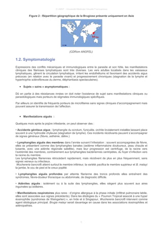 © UMVF - Université Médicale Virtuelle Francophone
Figure 2 : Répartition géographique de la Brugiose présente uniquement en Asie
(CDRom ANOFEL)
1.2. Symptomatologie
Expressions des conflits mécaniques et immunologiques entre le parasite et son hôte, les manifestations
cliniques des filarioses lymphatiques sont très diverses. Les vers adultes localisés dans les vaisseaux
lymphatiques, gênent la circulation lymphatique, irritent les endothéliums et favorisent des accidents aigus
précoces (en relation avec le parasite vivant) et progressivement chroniques (stagnation de la lymphe et
hypertrophie sclérofibreuse du derme, éléphantiasis spectaculaires).
● Sujets « sains » asymptomatiques :
Dû en partie à des résistances innées on doit noter l’existence de sujet sans manifestations cliniques ou
parasitologiques mais porteurs de stigmates immunologiques spécifiques.
Par ailleurs on identifie de fréquents porteurs de microfilaires sans signes cliniques d’accompagnement mais
pouvant assurer la transmission de l’affection.
● Manifestations aiguës :
Quelques mois après la piqûre infestante, on peut observer des :
• Accidents génitaux aigus : lymphangite du scrotum, funiculite, orchite brutalement installée laissant place
souvent à une hydrocèle chyleuse (stagnation de lymphe). Ces incidents récidivants peuvent s’accompagner
de signes généraux (fièvre, asthénie, délire.)
• Lymphangites aiguës des membres dans l’année suivant l’infestation : souvent accompagnées de fièvre,
elles se présentent comme des lymphangites banales (œdème inflammatoire douloureux, peau chaude et
luisante, avec une adénite régionale satellite), mais leur progression est centrifuge, de la racine vers
l’extrémité des membres, contrairement aux lymphangites bactériennes centripètes, du foyer d’infection vers
la racine du membre.
Les lymphangites filariennes rétrocèdent rapidement, mais récidivent de plus en plus fréquemment, sans
signes veineux ou infectieux.
Wuchereria bancrofti atteint surtout le membre inférieur, la variété pacifica le membre supérieur et B. malayi
la jambe, le cou de pied et le creux poplité.
• Lymphangites aiguës profondes par atteinte filarienne des troncs profonds elles entraînent des
syndromes, fièvre-douleur thoracique ou abdominale, de diagnostic difficile.
• Adénites aiguës : isolément ou à la suite des lymphangites, elles siègent plus souvent aux aires
inguinales qu’axillaires.
• Manifestations respiratoires plus rares : d’origine allergique à la phase initiale (infiltrat pulmonaire labile,
elles sont associées aux signes précédents). Dans les étiologies du « Poumon Tropical associé à une hyper
éosinophilie (syndromes de Weingarten) », en Inde et à Singapour, Wuchereria bancrofti intervient comme
agent étiologique principal. Brugia malayi serait davantage en cause dans les associations éosinophilies et
adénopathies.
6
 