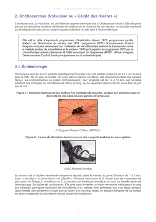 © UMVF - Université Médicale Virtuelle Francophone
2. Onchocercose (Volvulose ou « Cécité des rivières »)
L’onchocercose, ou volvulose, est une filariose cutanéo-dermique due à Onchocerca volvulus. Elle est grave
par ses complications oculaires cécitantes et constitue par la nuisance de son vecteur, un obstacle important
au développement des zones rurales irriguées et fertiles, où elle sévit à l’état endémique.
Elle est la cible d’importants programmes d’éradication depuis 1975, programmes fondés
d’abord sur l’éradication du vecteur (en 1974 : programme OCP « Onchocerciasis Control
Program ») et plus récemment sur l’utilisation de microfilaricides arrêtant la transmission entre
le malade porteur de microfilaires et le vecteur (1990 prolongation du programme OCP par la
chimiothérapie antimicrofilarienne et 1996 lancement du Programme APOC : African Program
Onchocerciasis Control, fondé principalement sur la chimiothérapie).
2.1. Épidémiologie
Onchocerca volvulus est un parasite spécifiquement humain. Les vers adultes mesurent de 2 à 3 cm de long
pour le mâle, 50 cm pour la femelle ; ils vivent dans le derme, soit libres, soit emprisonnés dans des nodules
fibreux, les onchocercomes ou kystes onchocerquiens ; leur longévité est de 10 à 15 ans. Les femelles
émettent des embryons ou microfilaires de 300 μ de long, qui se répandent dans le derme, aussi bien le jour
que la nuit.
Figure 7 : Simulium damnosum (ou Buffalo fly), semblant de mouche, vecteur de l’onchocercose et
dépendante des eaux douces agitées et herbeuses
(C.Guiguen Rennes CdRom ANOFEL)
Figure 8 : Larves de Simulium damnosum sur des supports herbeux en eaux agitées
(Col.D.Richard-Lenoble)
Le vecteur est un diptère nématocère largement répandu dans le monde du genre Simulium de 1 à 3 mm,
trapu, « simulant » un moucheron noir (blackfly). Simulium damnosum et S. neavei sont les complexes les
plus actifs en Afrique,S. metallicum et S. ochraceum en Amerique centrale et du sud. La femelle seule est
hématophage. Sa piqûre est douloureuse. Elle crée dans le derme un micro-hématome mélangeant le sang
aux sérosités dermiques contenant les microfilaires d’un malade ainsi prélevées lors d’un repas sanguin
(pool-feeder). Elle contamine le sujet sain au cours d’un nouveau repas, en laissant échapper de sa trompe
les larves infestantes qui traversent ensuite activement l’épiderme.
10
 