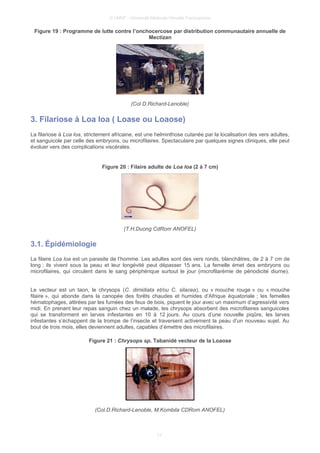 © UMVF - Université Médicale Virtuelle Francophone
Figure 19 : Programme de lutte contre l’onchocercose par distribution communautaire annuelle de
Mectizan
(Col D.Richard-Lenoble)
3. Filariose à Loa loa ( Loase ou Loaose)
La filariose à Loa loa, strictement africaine, est une helminthose cutanée par la localisation des vers adultes,
et sanguicole par celle des embryons, ou microfilaires. Spectaculaire par quelques signes cliniques, elle peut
évoluer vers des complications viscérales.
Figure 20 : Filaire adulte de Loa loa (2 à 7 cm)
(T.H.Duong CdRom ANOFEL)
3.1. Épidémiologie
La filaire Loa loa est un parasite de l’homme. Les adultes sont des vers ronds, blanchâtres, de 2 à 7 cm de
long : ils vivent sous la peau et leur longévité peut dépasser 15 ans. La femelle émet des embryons ou
microfilaires, qui circulent dans le sang périphérique surtout le jour (microfilarémie de périodicité diurne).
Le vecteur est un taon, le chrysops (C. dimidiata et/ou C. silacea), ou « mouche rouge » ou « mouche
filaire », qui abonde dans la canopée des forêts chaudes et humides d’Afrique équatoriale ; les femelles
hématophages, attirées par les fumées des feux de bois, piquent le jour avec un maximum d’agressivité vers
midi. En prenant leur repas sanguin chez un malade, les chrysops absorbent des microfilaires sanguicoles
qui se transforment en larves infestantes en 10 à 12 jours. Au cours d’une nouvelle piqûre, les larves
infestantes s’échappent de la trompe de l’insecte et traversent activement la peau d’un nouveau sujet. Au
bout de trois mois, elles deviennent adultes, capables d’émettre des microfilaires.
Figure 21 : Chrysops sp. Tabanidé vecteur de la Loaose
(Col.D.Richard-Lenoble, M.Kombila CDRom ANOFEL)
17
 