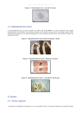 © UMVF - Université Médicale Virtuelle Francophone
Figure 3 : Hymenolepis nana - oeuf [45 x 35 µm]
1.4. Diphyllobotrium latum
Le bothriocéphale est un grand cestode qui atteint 10 à 15 mètres. Le scolex présente deux fentes
longitudinales, les bothridies. Les derniers anneaux de la chaîne, qui peuvent en comporter jusqu’à 4000,
plus larges que longs, ont un aspect trapézoïdal. Le pore génital de chacun d’eux, bien visible à l’image, est
médian et ventral.
Figure 4 : Diphyllobothrium latum (bothriocéphale) - adulte
Figure 5 : Diphyllobothrium latum - Détail des anneaux
Figure 6 : Diphyllobothrium latum - oeuf [60-70 x 40-45 µm]
2. Cycles
2.1. Taenia saginata
A maturité, les proglottis se détachent un à un du strobile. Cinq à 10 anneaux mobiles sont expulsés chaque
6
 