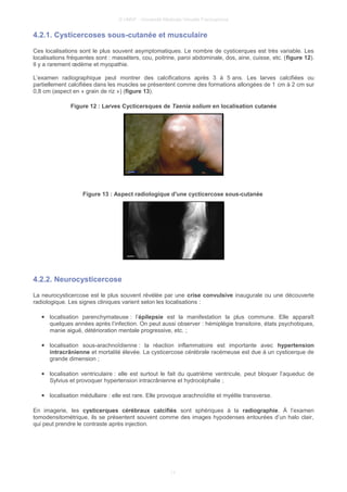 © UMVF - Université Médicale Virtuelle Francophone
4.2.1. Cysticercoses sous-cutanée et musculaire
Ces localisations sont le plus souvent asymptomatiques. Le nombre de cysticerques est très variable. Les
localisations fréquentes sont : masséters, cou, poitrine, paroi abdominale, dos, aine, cuisse, etc. (figure 12).
Il y a rarement œdème et myopathie.
L’examen radiographique peut montrer des calcifications après 3 à 5 ans. Les larves calcifiées ou
partiellement calcifiées dans les muscles se présentent comme des formations allongées de 1 cm à 2 cm sur
0,8 cm (aspect en « grain de riz ») (figure 13).
Figure 12 : Larves Cycticersques de Taenia solium en localisation cutanée
Figure 13 : Aspect radiologique d'une cycticercose sous-cutanée
4.2.2. Neurocysticercose
La neurocysticercose est le plus souvent révélée par une crise convulsive inaugurale ou une découverte
radiologique. Les signes cliniques varient selon les localisations :
● localisation parenchymateuse : l’épilepsie est la manifestation la plus commune. Elle apparaît
quelques années après l’infection. On peut aussi observer : hémiplégie transitoire, états psychotiques,
manie aiguë, détérioration mentale progressive, etc. ;
● localisation sous-arachnoïdienne : la réaction inflammatoire est importante avec hypertension
intracrânienne et mortalité élevée. La cysticercose cérébrale racémeuse est due à un cysticerque de
grande dimension ;
● localisation ventriculaire : elle est surtout le fait du quatrième ventricule, peut bloquer l’aqueduc de
Sylvius et provoquer hypertension intracrânienne et hydrocéphalie ;
● localisation médullaire : elle est rare. Elle provoque arachnoïdite et myélite transverse.
En imagerie, les cysticerques cérébraux calcifiés sont sphériques à la radiographie. À l’examen
tomodensitométrique, ils se présentent souvent comme des images hypodenses entourées d’un halo clair,
qui peut prendre le contraste après injection.
11
 