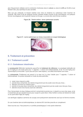 © UMVF - Université Médicale Virtuelle Francophone
plus fréquemment utilisées sont la recherche d’anticorps dans le sérum ou dans le LCR par ELISA et par
Western blot, plus spécifique et plus sensible.
Bien que peu pratiquée, la biopsie exérèse avec mise en évidence du cysticerque reste l’examen de
certitude. Elle reste le fait de quelques formes cutanées faciles d’accès et peu traumatiques, de quelques
formes neurologiques dont la gravité impose la chirurgie, ou encore des rares formes oculaires.
Figure 20 : Taenia solium : larve cysticerque ouverte
Figure 21 : Larve cysticerque au niveau musculaire en coupe histologique
6. Traitement et prévention
6.1. Traitement curatif
6.1.1. Cestodoses intestinales
Le praziquantel (Biltricide) représente aujourd’hui le traitement de référence. La posologie habituelle est
de 10 mg/kg en une seule prise pour T. saginata, T. solium et le bothriocéphale, et de 15 à 25 mg/kg pour
Hymenolepis (à renouveler 7 jours plus tard pour cette espèce). Les effets secondaires sont rares.
Le niclosamide (Trédémine) est prescrit à la dose de 2 g chez l’adulte pour T. saginata, T. solium et
bothriocéphale. Ce produit nécessite un mode de prise particulier :
● rester à jeun depuis la veille ;
● prendre deux comprimés, les mâcher longuement puis les avaler avec très peu d’eau ;
● attendre une heure en restant à jeun ;
● prendre à nouveau deux comprimés, les mâcher longuement puis les avaler avec très peu d’eau ;
● attendre encore trois heures avant de s’alimenter.
Pour Hymenolepis, la dose d’attaque est de 4 comprimés le premier jour, à répartir au cours des repas, et de
2 comprimés par jour pendant 6 jours pour couper le cycle direct. Chez l’enfant, la dose est réduite de moitié
ou du quart selon l’âge (30 mg/kg).
Les tænifuges végétaux (semence de courge) sont pratiquement abandonnés sauf pour la femme enceinte.
En cas d’anémie dans la bothriocéphalose, la vitamine B12 doit être prescrite en complément.
Dans tous les cas, il faut prescrire un contrôle parasitologique 3 mois après traitement.
15
 