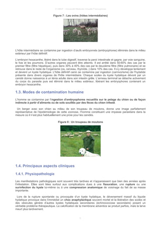 © UMVF - Université Médicale Virtuelle Francophone
Figure 7 : Les ovins (hôtes intermédiaires)
L’hôte intermédiaire se contamine par ingestion d’œufs embryonnés (embryophores) éliminés dans le milieu
extérieur par l’hôte définitif.
L’embryon hexacanthe, libéré dans le tube digestif, traverse la paroi intestinale et gagne, par voie sanguine,
le foie et les poumons. D’autres organes peuvent être atteints. Il est arrêté dans 50-60% des cas par le
premier filtre (filtre hépatique), puis dans 30% à 40% des cas par le deuxième filtre (filtre pulmonaire) et se
retrouve dans le reste de l’organisme (os, cerveau, thyroïde..) dans 10% des cas. Il s’y développe lentement
et devient un kyste hydatique. L'hôte définitif canin se contamine par ingestion (carnivorisme) de l’hydatide
présente dans divers organes de l'hôte intermédiaire. Chaque scolex du kyste hydatique dévoré par un
canidé donne naissance à un ténia adulte dans son intestin grêle. L’anneau terminal se détache activement
du corps du parasite puis est éliminé dans le milieu extérieur, libérant les embryophores contenant un
embryon hexacanthe.
1.3. Modes de contamination humaine
L’homme se contamine par l'ingestion d’embryophores recueillis sur le pelage du chien ou de façon
indirecte à partir d’aliments ou de sols souillés par des fèces du chien infesté.
Un berger avec son chien au milieu de son troupeau de moutons, donne une image parfaitement
représentative de l’épidémiologie de cette zoonose, l’homme constituant une impasse parasitaire dans la
mesure où il n’est plus habituellement une proie pour les canidés.
Figure 8 : Un troupeau de moutons
1.4. Principaux aspects cliniques
1.4.1. Physiopathologie
Les manifestations pathologiques sont souvent très tardives et n'apparaissent que bien des années après
l'infestation. Elles sont liées surtout aux complications dues à une fissuration, une rupture ou une
surinfection du kyste lui-même ou à une compression anatomique de voisinage du fait de sa masse
importante.
Lors de la rupture spontanée ou provoquée d’un kyste hydatique, le déversement massif du liquide
hydatique provoque dans l’immédiat un choc anaphylactique souvent mortel et la libération des scolex et
des vésicules génère d’autres kystes hydatiques secondaires (échinococcose secondaire) posant un
véritable problème thérapeutique. La calcification de la membrane adventice se produit parfois, mais la larve
meurt plus tardivement.
6
 
