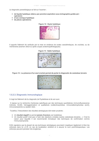 © UMVF - Université Médicale Virtuelle Francophone
Le diagnostic parasitologique se fait sur l’examen :
● de liquide hydatique obtenu par ponction-aspiration sous échographie guidée per-
opératoire
● d’une vomique hydatique
● de pièces opératoires
Figure 12 : Kyste hydatique
Il apporte l’élément de certitude par la mise en évidence de scolex caractéristiques, de crochets, ou de
membranes (examen direct ou après coupes anatomopathologiques).
Figure 13 : Sable hydatique
Figure 14 : La présence d'un seul crochet permet de porter le diagnostic de cestodose larvaire
1.5.2.3. Diagnostic immunologique
Il s'agit de l'élément clé du diagnostic de l'hydatidose et de son suivi.
Il repose sur la recherche d’anticorps spécifiques par des techniques quantitatives (immunofluorescence
indirecte, ELISA, hémagglutination) et qualitatives (coélectrosynérèse, immunoélectrophorèse (arc5),
immunoempreinte ou western blot).
Toutefois, l’interprétation des résultats sérologiques doit rester prudente :
● Un résultat négatif ne permet jamais d’exclure une hydatidose.
● Un résultat positif n’est pas à l’abri des réactions croisées (autres cestodoses larvaires…). C’est la
raison pour laquelle il est recommandé d’employer des techniques de confirmation comme
l’immunoempreinte.
Enfin signalons que la plupart de ces techniques sérologiques pourraient s’appliquer également à titrer les
anticorps dans le L.C.R. en cas de localisation cérébral et à assurer le suivi post-thérapeutique. Les
anticorps peuvent persister très longtemps.
9
 