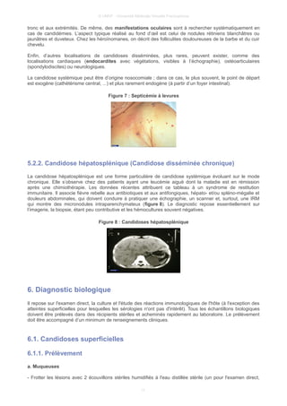© UMVF - Université Médicale Virtuelle Francophone
tronc et aux extrémités. De même, des manifestations oculaires sont à rechercher systématiquement en
cas de candidémies. L’aspect typique réalisé au fond d’œil est celui de nodules rétiniens blanchâtres ou
jaunâtres et duveteux. Chez les héroïnomanes, on décrit des folliculites douloureuses de la barbe et du cuir
chevelu.
Enfin, d’autres localisations de candidoses disséminées, plus rares, peuvent exister, comme des
localisations cardiaques (endocardites avec végétations, visibles à l’échographie), ostéoarticulaires
(spondylodiscites) ou neurologiques.
La candidose systémique peut être d’origine nosocomiale ; dans ce cas, le plus souvent, le point de départ
est exogène (cathétérisme central, ...) et plus rarement endogène (à partir d’un foyer intestinal).
Figure 7 : Septicémie à levures
5.2.2. Candidose hépatosplénique (Candidose disséminée chronique)
La candidose hépatosplénique est une forme particulière de candidose systémique évoluant sur le mode
chronique. Elle s’observe chez des patients ayant une leucémie aiguë dont la maladie est en rémission
après une chimiothérapie. Les données récentes attribuent ce tableau à un syndrome de restitution
immunitaire. Il associe fièvre rebelle aux antibiotiques et aux antifongiques, hépato- et/ou spléno-mégalie et
douleurs abdominales, qui doivent conduire à pratiquer une échographie, un scanner et, surtout, une IRM
qui montre des micronodules intraparenchymateux (figure 8). Le diagnostic repose essentiellement sur
l’imagerie, la biopsie, étant peu contributive et les hémocultures souvent négatives.
Figure 8 : Candidoses hépatosplénique
6. Diagnostic biologique
Il repose sur l'examen direct, la culture et l'étude des réactions immunologiques de l'hôte (à l'exception des
atteintes superficielles pour lesquelles les sérologies n'ont pas d'intérêt). Tous les échantillons biologiques
doivent être prélevés dans des récipients stériles et acheminés rapidement au laboratoire. Le prélèvement
doit être accompagné d’un minimum de renseignements cliniques.
6.1. Candidoses superficielles
6.1.1. Prélèvement
a. Muqueuses
- Frotter les lésions avec 2 écouvillons stériles humidifiés à l'eau distillée stérile (un pour l'examen direct,
11
 